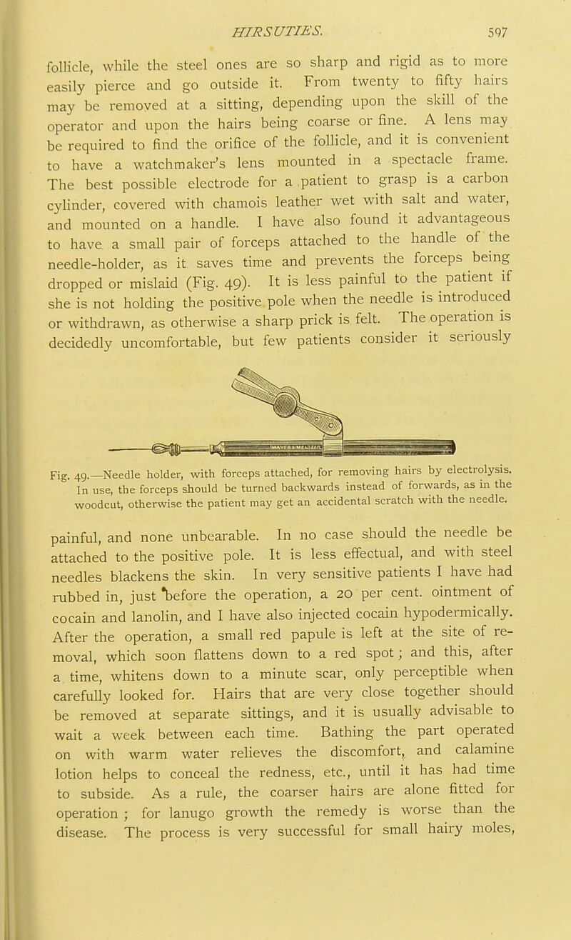 follicle, while the steel ones are so sharp and rigid as to more easily'pierce and S° outside it. From twenty to fifty hairs may be removed at a sitting, depending upon the skill of the operator and upon the hairs being coarse or fine. A lens may be required to find the orifice of the follicle, and it is convenient to have a watchmaker's lens mounted in a spectacle frame. The best possible electrode for a patient to grasp is a carbon cylinder, covered with chamois leather wet with salt and water, and mounted on a handle. I have also found it advantageous to have a small pair of forceps attached to the handle of the needle-holder, as it saves time and prevents the forceps being dropped or mislaid (Fig. 49). I* is less painful to the patient if she is not holding the positive, pole when the needle is introduced or withdrawn, as otherwise a sharp prick is felt. The operation is decidedly uncomfortable, but few patients consider it seriously Fig. 49.—Needle holder, with forceps attached, for removing hairs by electrolysis. In use, the forceps should be turned backwards instead of forwards, as in the woodcut, otherwise the patient may get an accidental scratch with the needle. painful, and none unbearable. In no case should the needle be attached to the positive pole. It is less effectual, and with steel needles blackens the skin. In very sensitive patients I have had rubbed in, just before the operation, a 20 per cent, ointment of cocain and lanolin, and I have also injected cocain hypodermically. After the operation, a small red papule is left at the site of re- moval, which soon flattens down to a red spot; and this, after a time, whitens down to a minute scar, only perceptible when carefully looked for. Hairs that are very close together should be removed at separate sittings, and it is usually advisable to wait a week between each time. Bathing the part operated on with warm water relieves the discomfort, and calamine lotion helps to conceal the redness, etc., until it has had time to subside. As a rule, the coarser hairs are alone fitted for operation ; for lanugo growth the remedy is worse than the disease. The process is very successful for small hairy moles,