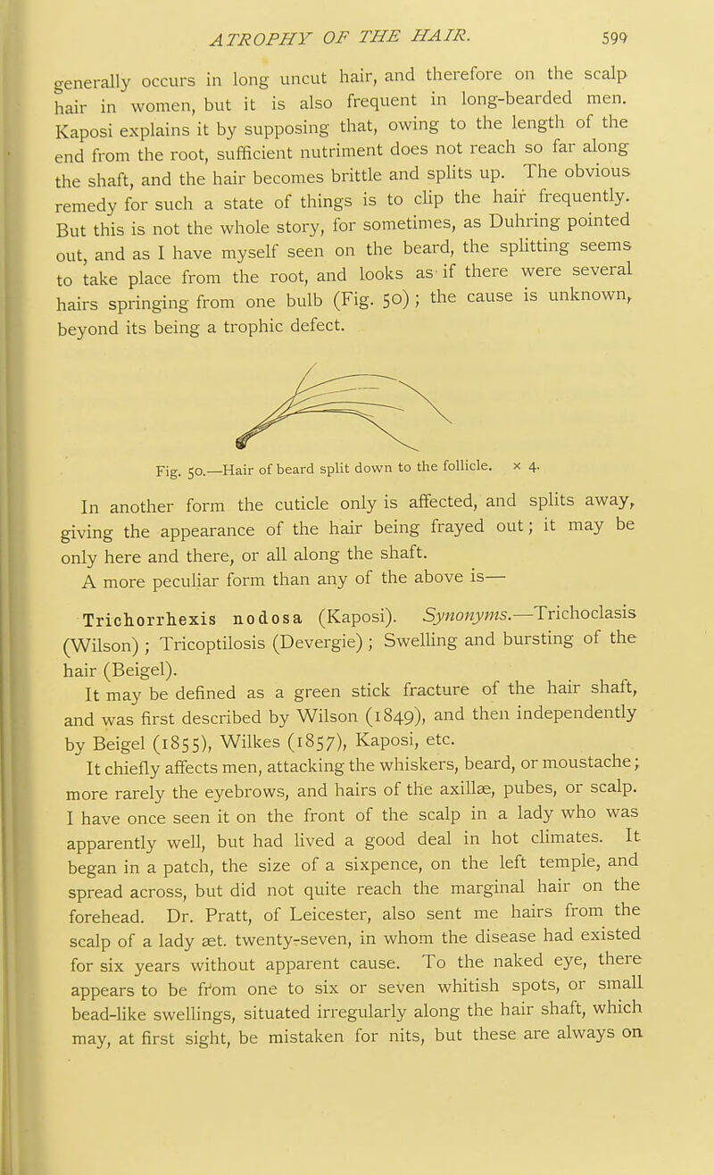 generally occurs in long uncut hair, and therefore on the scalp hair in women, but it is also frequent in long-bearded men. Kaposi explains it by supposing that, owing to the length of the end from the root, sufficient nutriment does not reach so far along the shaft, and the hair becomes brittle and splits up. The obvious remedy for such a state of things is to clip the hair frequently. But this is not the whole story, for sometimes, as Duhring pointed out, and as I have myself seen on the beard, the splitting seems to take place from the root, and looks as- if there were several hairs springing from one bulb (Fig. 50) J the cause is unknown, beyond its being a trophic defect. Fig. 50.—Hair of beard split down to the follicle. x 4. In another form the cuticle only is affected, and splits away, giving the appearance of the hair being frayed out; it may be only here and there, or all along the shaft. A more peculiar form than any of the above is— Trichorrhexis nodosa (Kaposi). Synonyms— Trichoclasis (Wilson) ; Tricoptilosis (Devergie) ; Swelling and bursting of the hair (Beigel). It may be defined as a green stick fracture of the hair shaft, and was first described by Wilson (1849), and then independently by Beigel (1855), Wilkes (1857), Kaposi, etc. It chiefly affects men, attacking the whiskers, beard, or moustache; more rarely the eyebrows, and hairs of the axillae, pubes, or scalp. I have once seen it on the front of the scalp in a lady who was apparently well, but had lived a good deal in hot climates. It began in a patch, the size of a sixpence, on the left temple, and spread across, but did not quite reach the marginal hair on the forehead. Dr. Pratt, of Leicester, also sent me hairs from the scalp of a lady aet. twenty-seven, in whom the disease had existed for six years without apparent cause. To the naked eye, there appears to be from one to six or seven whitish spots, or small bead-like swellings, situated irregularly along the hair shaft, which may, at first sight, be mistaken for nits, but these are always on