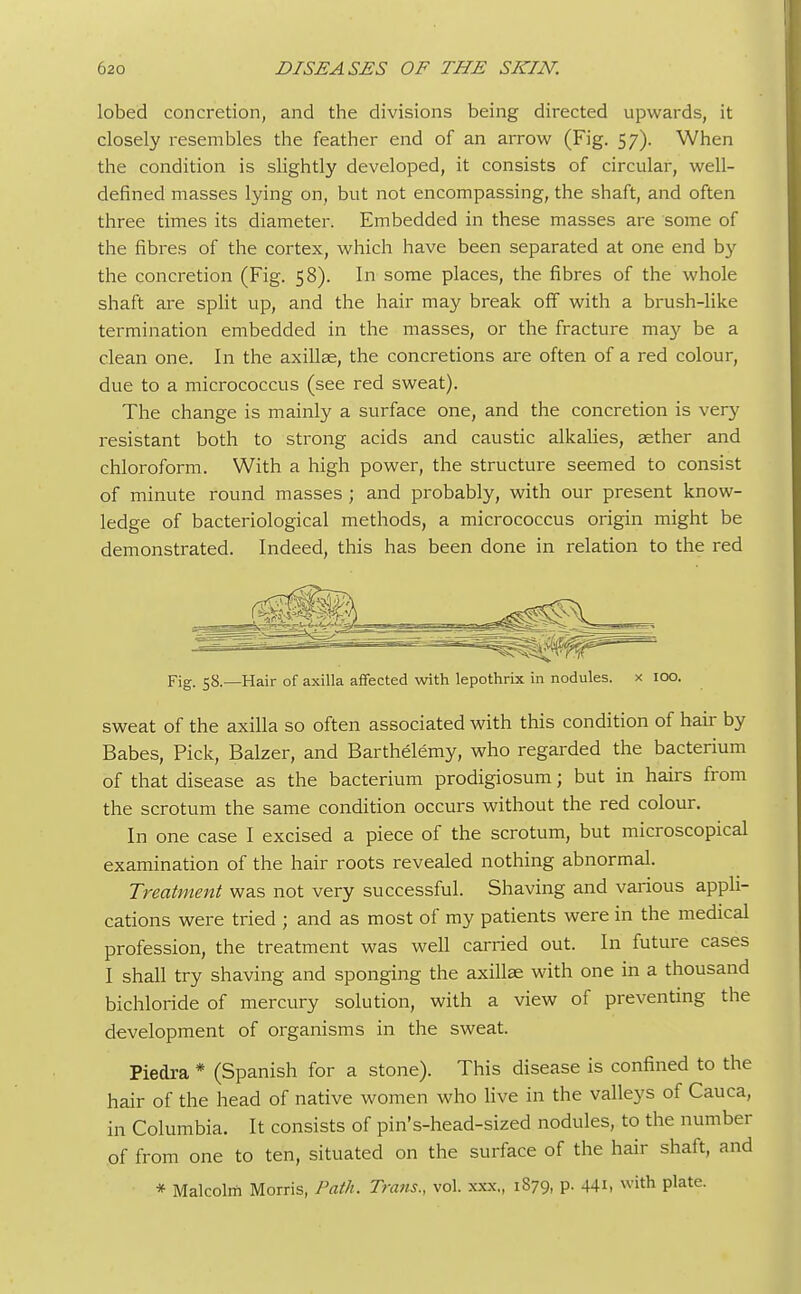 lobed concretion, and the divisions being directed upwards, it closely resembles the feather end of an arrow (Fig. 57). When the condition is slightly developed, it consists of circular, well- defined masses lying on, but not encompassing, the shaft, and often three times its diameter. Embedded in these masses are some of the fibres of the cortex, which have been separated at one end by the concretion (Fig. 58). In some places, the fibres of the whole shaft are split up, and the hair may break off with a brush-like termination embedded in the masses, or the fracture ma}' be a clean one. In the axillae, the concretions are often of a red colour, due to a micrococcus (see red sweat). The change is mainly a surface one, and the concretion is very resistant both to strong acids and caustic alkalies, aether and chloroform. With a high power, the structure seemed to consist of minute round masses ; and probably, with our present know- ledge of bacteriological methods, a micrococcus origin might be demonstrated. Indeed, this has been done in relation to the red Fig. 58.—Hair of axilla affected with lepothrix in nodules. x 100. sweat of the axilla so often associated with this condition of hair by Babes, Pick, Balzer, and Barthelemy, who regarded the bacterium of that disease as the bacterium prodigiosum; but in hairs from the scrotum the same condition occurs without the red colour. In one case I excised a piece of the scrotum, but microscopical examination of the hair roots revealed nothing abnormal. Treatment was not very successful. Shaving and various appli- cations were tried ; and as most of my patients were in the medical profession, the treatment was well carried out. In future cases I shall try shaving and sponging the axillae with one in a thousand bichloride of mercury solution, with a view of preventing the development of organisms in the sweat. Piedra * (Spanish for a stone). This disease is confined to the hair of the head of native women who live in the valleys of Cauca, in Columbia. It consists of pin's-head-sized nodules, to the number of from one to ten, situated on the surface of the hair shaft, and * Malcolm Morris, Path. Trans., vol. xxx„ 1879, p. 44i, with plate.