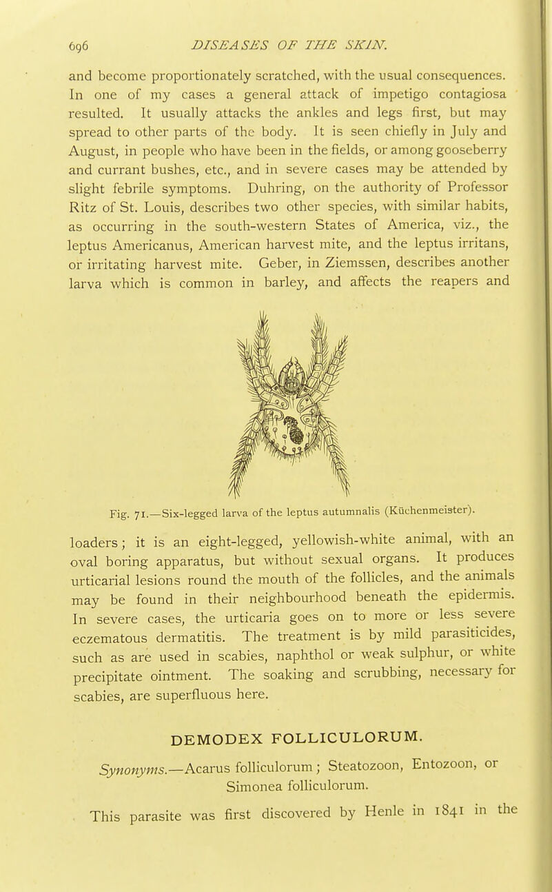 and become proportionately scratched, with the usual consequences. In one of my cases a general attack of impetigo contagiosa resulted. It usually attacks the ankles and legs first, but may spread to other parts of the body. It is seen chiefly in July and August, in people who have been in the fields, or among gooseberry and currant bushes, etc., and in severe cases may be attended by slight febrile symptoms. Duhring, on the authority of Professor Ritz of St. Louis, describes two other species, with similar habits, as occurring in the south-western States of America, viz., the leptus Americanus, American harvest mite, and the leptus irritans, or irritating harvest mite. Geber, in Ziemssen, describes another larva which is common in barley, and affects the reapers and Fig. 71.—Six-legged larva of the leptus autumnalis (Kuchenmeis-ter). loaders; it is an eight-legged, yellowish-white animal, with an oval boring apparatus, but without sexual organs. It produces urticarial lesions round the mouth of the follicles, and the animals may be found in their neighbourhood beneath the epidermis. In severe cases, the urticaria goes on to more or less severe eczematous dermatitis. The treatment is by mild parasiticides, such as are used in scabies, naphthol or weak sulphur, or white precipitate ointment. The soaking and scrubbing, necessary for scabies, are superfluous here. DEMODEX FOLLICULORUM. Synonyms.—Acarus folliculorum; Steatozoon, Entozoon, or Simonea folliculorum. This parasite was first discovered by Henle in 1841 in the