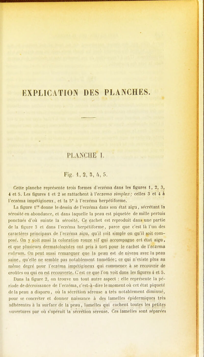 EXPLICATION DES PLANCHES. PLANCHE I. Fig. 1, 2, 3, k, 5. Cette planche représente trois formes d'eczéma dans les figures 1, 2, 3, 4 et 5. Les figures 1 et 2 se rattachent à Yeczema simplex; celles 3 et 4 à l'eczéma impétigineux, et la 5e à l'eczéma herpétiforme. La figure 1 donne le dessin de l'eczéma dans son état aigu, sécrétant la sérosité en abondance, et dans laquelle la peau est piquetée de mille pertuis ponctués d'où suinte la sérosité. Ce cachet est reproduit dans une partie de la figure 3 et dans l'eczéma herpétiforme, parce que c'est là l'un des caractères principaux de l'eczéma aigu, qu'il soit simple ou qu'il soit com- posé. On y Voit aussi la coloration rouge vif qui accompagne cet état aigu , et que plusieurs dermatologistes ont pris à tort pour le cachet de Yeczema rubrum. On peut aussi remarquer que la peau est de niveau avec la peau saine, qu'elle ne semble pas notablement tuméfiée; ce qui n'existe plus au même degré pour l'eczéma impétigineux qui commence à se recouvrir de croûtes ou qui en est recouverte. C'est ce que l'on voit dans les figures !• et 5. Dans la figure 2, on trouve un tout autre aspect : elle représente la pé- riode de décroissance de l'eczéma, c'est-à-dire le moment où cet état piqueté delà peau a disparu, où la sécrétion séreuse a très notablement diminué, pour se concréter et donner naissance à des lamelles épidcrmiques très adhérentes à la surface de la peau, lamelles qui cachent toutes les petites ouvertures par où s'opérait la sécrétion séreuse. Ces lamelles sont séparées