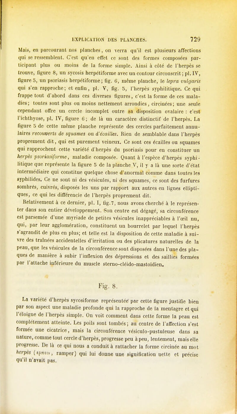 Mais, en parcourant nos planches, on verra qu'il est plusieurs affections qui se ressemblent. C'est qu'eu effet ce sont des formes composées par- ticipant plus ou moins de la forme simple. Ainsi à côté de l'herpès se trouve, figure 8, un sycosis herpétiforme avec un contour circonscrit ; pl. IV, figure 5, un psoriasis herpétiforme ; fig. 6, même planche, le lepra vulcjaris qui s'en rapproche; et enfin, pl. V, fig. 5, l'herpès syphilitique. Ce qui frappe tout d'abord dans ces diverses figures, c'est la forme de ces mala- dies; toutes sont plus ou moins nettement arrondies, circinées; une seule cependant offre un cercle incomplet outre sa disposition ovalaire : c'est l'ichthyose, pl. IV, figure 6 ; de là un caractère distinctif de l'herpès. La figure 5 de cette même planche représente des cercles parfaitement annu- laires recouverts de squames ou d'écaillés. Rien de semblable dans l'herpès proprement dit, qui est purement veineux. Ce sont ces écailles ou squames qui rapprochent cette variété d'herpès du psoriasis pour en constituer un herpès psoriasiforme, maladie composée. Quant à l'espèce d'herpès syphi- litique que représente la figure 5 de la planche V, il y a là une sorte d'état intermédiaire qui constitue quelque chose d'anormal comme dans toutes les syphilides. Ce ne sont ni des vésicules, ni des squames, ce sont des furfures sombrés, cuivrés, disposés les uns par rapport aux autres en lignes ellipti- ques, ce qui les différencie de l'herpès proprement dit. Relativement à ce dernier, pl. I, fig.7, nous avons cherché à le représen- ter dans son entier développement. Son centre est dégagé, sa circonférence est parsemée d'une myriade de petites vésicules inappréciables à l'œil nu, qui, par leur agglomération, constituent un bourrelet par lequel l'herpès s'agrandit de plus en plus; et telle est la disposition de cette maladie à sui- vre des traînées accidentelles d'irritation ou des plicatures naturelles de la peau, que les vésicules de la circonférence sont disposées dans l'une des pla- ques de manière à subir l'inflexion des dépressions et des saillies formées par l'attache inférieure du muscle sterno-cléido-mastoïdien. Fig. 8. La variété d'herpès sycosiforme représentée par cette figure justifie bien par son aspect une maladie profonde qui la rapproche de la mentagre et qui l'éloigné de l'herpès simple. On voit comment daus cette forme la peau est complètement atteinte. Les poils sont tombés ; au centre de l'affection s'est formée une cicatrice, mais la circonférence vésiculo-pustuleuse dans sa nature, comme tout cercle d'herpès, progresse peu à peu, lentement, mais elle progresse. De là ce qui nous a conduit à rattacher la forme circinée au mot herpès (ipra'.v, ramper) qui lui donne une signification ucllc et précise qu'il n'avait pas.