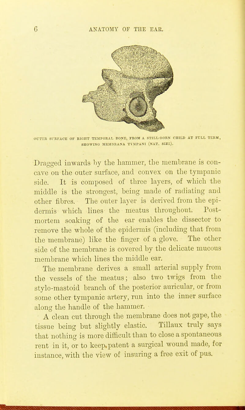 OUTER SURFACE OF RIGHT TEMPORAL BONE, FROM A STILL-BORN CHILD AT FULL TERM, SHOWING MEMBRANA TYMPANI (NAT. SIZE). Dragged inwards by the hammer, the membrane is con- cave on the outer surface, and convex on the tympanic side. It is composed of three layers, of which the middle is the strongest, being made of radiating and other fibres. The outer layer is derived from the epi- dermis which lines the meatus throughout. Post- mortem soaking of the ear enables the dissector to remove the whole of the epidermis (including that from the membrane) like the finger of a glove. The other side of the membrane is covered by the delicate mucous membrane which lines the middle ear. The membrane derives a small arterial supply from the vessels of the meatus; also two twigs from the stylo-mastoid branch of the posterior auricular, or from some other tympanic artery, run into the inner surface along the handle of the hammer. A clean cut through the membrane does not gape, the tissue being but slightly elastic. Tillaux truly says that nothing is more difficult than to close a spontaneous rent in it, or to keep, patent a surgical wound made, for instance, with the view of insuring a free exit of pus.