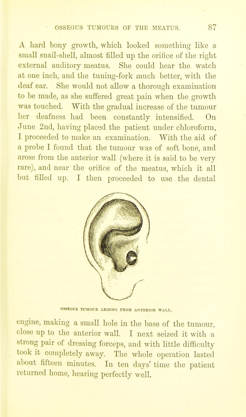 A hard bony growth, which looked something like a small snail-shell, almost filled up the orifice of the right external auditory meatus. She could hear the watch at one inch, and the tuning-fork much better, with the deaf ear. She would not allow a thorough examination to be made, as she suffered great pain when the growth was touched. With the gradual increase of the tumour her deafness had been constantly intensified. On June 2nd, having placed the patient under chloroform, I proceeded to make an examination. With the aid of a probe I found that the tumour was of soft bone, and arose from the anterior wall (where it is said to be very rare), and near the orifice of the meatus, which it all but filled up. I then proceeded to use the dental OSSEOUS TUMOUR ARISING FROM ANTERIOR WALL. engine, making a small hole in the base of the tumour, close up to the anterior wall. I next seized it with a strong pair of dressing forceps, and with little difficulty took it completely away. The whole operation lasted about fifteen minutes. In ten days' time the patient returned home, hearing perfectly well.