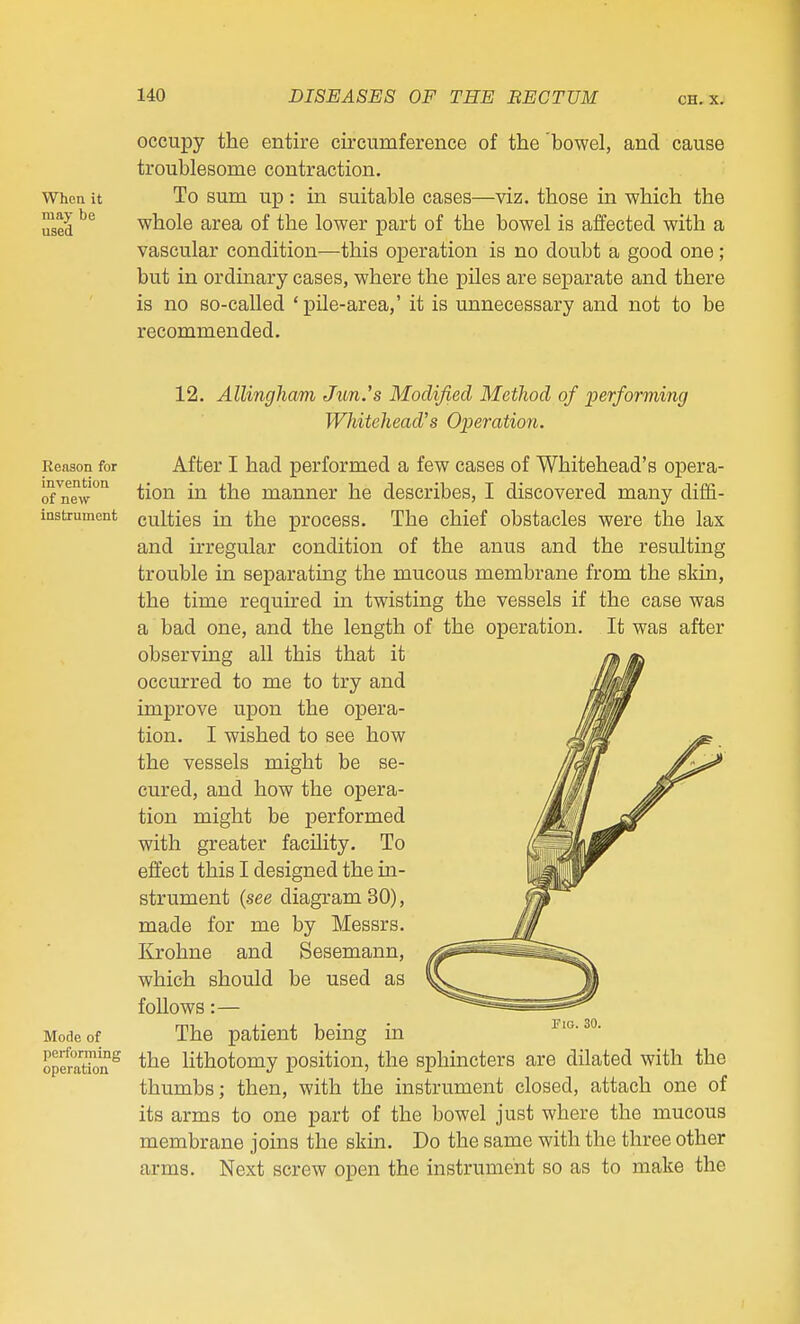 occupy the entire circuraference of the 'bowel, and cause troublesome contraction. When it To sum up : in suitable cases—viz. those in which the used whole area of the lower part of the bowel is affected with a vascular condition—this operation is no doubt a good one; but in ordinary cases, where the piles are separate and there is no so-called 'pile-area,' it is unnecessary and not to be recommended. Reason for invention of new instrument 12. Allingham Jun.'s Modified Method of performing Whitehead's Operation. After I had performed a few cases of Whitehead's opera- tion in the manner he describes, I discovered many diffi- culties in the process. The chief obstacles were the lax and irregular condition of the anus and the resulting trouble in separating the mucous membrane from the skin, the time required in twisting the vessels if the case was a bad one, and the length of the operation. It was after observing all this that it occurred to me to try and improve upon the opera- tion. I wished to see how the vessels might be se- cured, and how the opera- tion might be performed with greater facility. To effect this I designed the in- strument (see diagram 30), made for me by Messrs. Krohne and Sesemann, which should be used as follows:— Mode of The patient being in op^^a'tTon^ the lithotomy position, the sphincters are dilated with the thumbs; then, with the instrument closed, attach one of its arms to one part of the bowel just where the mucous membrane joins the skin. Do the same with the three other arms. Next screw open the instrument so as to make the Fig. 30.