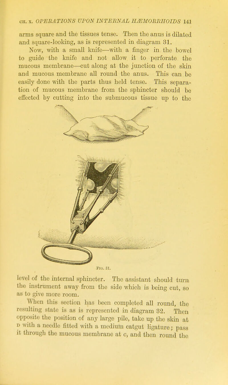 arms square and the tissues tense. Then the anus is dilated and square-looking, as is represented in diagram 31. Now, with a small knife—with a finger in the bowel to guide the knife and not allow it to perforate the mucous membrane—cut along at the junction of the skin and mucous membrane all round the anus. This can be easily done with the parts thus held tense. This separa- tion of mucous membrane from the sphincter should be effected by cutting into the submucous tissue up to the Fio. 31. level of the internal sphincter. The assistant should turn the instrument away from the side which is being cut, so as to give more room. When this section has been completed all round, the resulting state is as is represented in diagram 32. Then opposite the position of any large pile, take up the skin at D with a needle fitted with a medium catgut ligature; pass it through the mucous membrane at c, and then round the