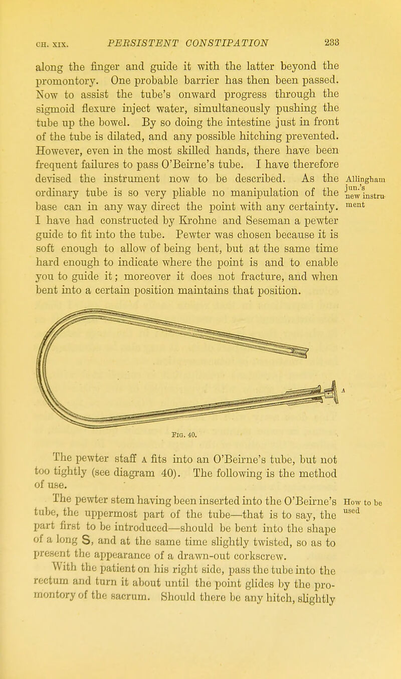 along the finger and guide it with the latter beyond the promontory. One probable barrier has then been passed. Now to assist the tube's onward progress through the sigmoid fiesm-e inject water, simultaneously pushing the tube up the bowel. By so doing the intestine just in front of the tube is dilated, and any possible hitching prevented. However, even in the most skilled hands, there have been fi-equent failures to pass O'Beirne's tube. I have therefore devised the mstrument now to be described. As the Aiiingham ordinary tube is so very phable no manipulation of the new lustra- base can in any way dhect the point with any certainty. I have had constructed by Krohne and Seseman a pewter guide to fit into the tube. Pewter was chosen because it is soft enough to allow of being bent, but at the same time hard enough to indicate where the point is and to enable you to guide it; moreover it does not fractm'e, and when bent into a certain position maintains that position. Fig. 40. The pewter staff a fits into an O'Beirne's tube, but not too tightly (see diagi-am 40). The following is the method of u.se. The pewter stem having been inserted into the O'Beirne's How to be tube, the uppermost part of the tube—that is to say, the '^ part first to be introduced—should be bent into the shape of a long S, and at the same time slightly twisted, so as to present the appearance of a drawn-out corkscrew. With the patient on his right side, pass the tube into the rectum and turn it about until the point glides by the pro- montory of the sacrum. Should there be any hitch, slightly