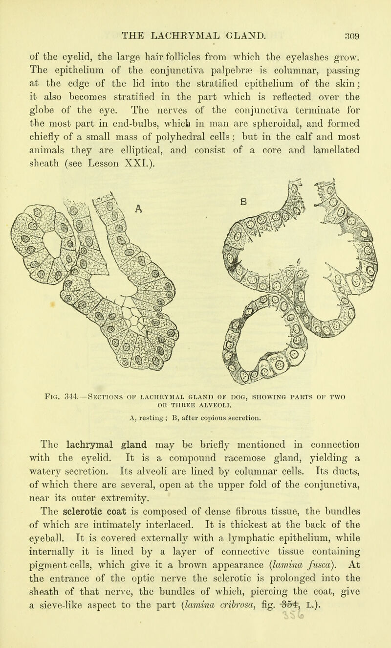 of the eyelid, the large hair-follicles from which the eyelashes grow. The epithelium of the conjunctiva palpebrae is columnar, passing at the edge of the lid into the stratified epithelium of the skin; it also becomes stratified in the part which is reflected over the globe of the eye. The nerves of the conjunctiva terminate for the most part in end-bulbs, which in man are spheroidal, and formed chiefly of a small mass of polyhedral cells; but in the calf and most animals they are elliptical, and consist of a core and lamellated sheath (see Lesson XXL). Fig. 344.—Sections of lachrymal gland of dog, showing parts of two or three alveoll A, resting; B, after copious secretion. The lachrymal gland may be briefly mentioned in connection with the eyelid. It is a compound racemose gland, yielding a watery secretion. Its alveoli are lined by columnar cells. Its ducts, of which there are several, open at the upper fold of the conjunctiva, near its outer extremity. The sclerotic coat is composed of dense fibrous tissue, the bundles of which are intimately interlaced. It is thickest at the back of the eyeball. It is covered externally with a lymphatic epithelium, while internally it is lined by a layer of connective tissue containing pigment-cells, which give it a brown appearance {lamina fusca). At the entrance of the optic nerve the sclerotic is prolonged into the sheath of that nerve, the bundles of which, piercing the coat, give a sieve-like aspect to the part {lamina cribrosa, fig. 354, L.).