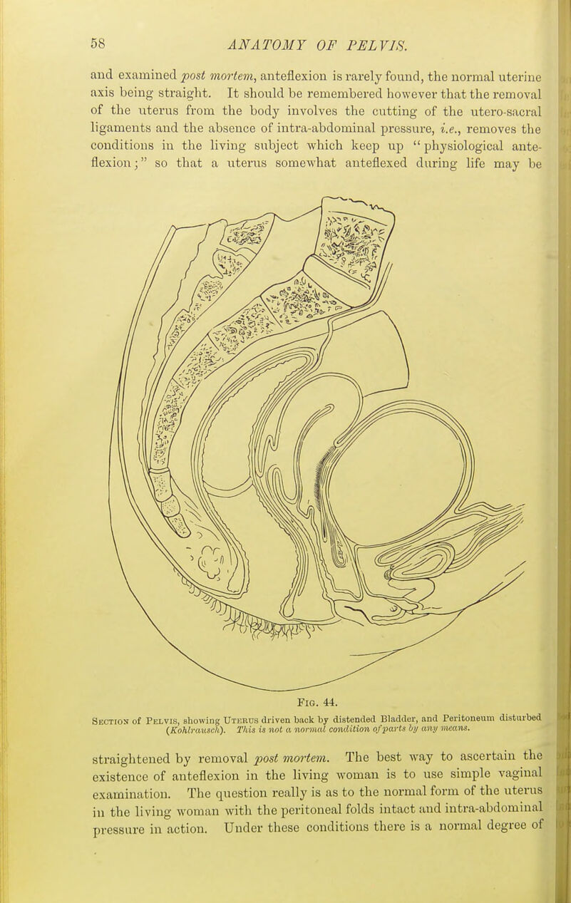 and examined post mortem, anteflexion is rarely found, the normal uterine axis being straight. It should be remembered however that the removal of the uterus from the body involves the cutting of the utero-sacral ligaments and the absence of intra-abdominal pressure, i.e., removes the conditions in the living subject which keep up  physiological ante- flexion ; so that a uterus somewhat anteflexed during life may be Fig. 44. Section of Pelvis, showing Uterus driven back by distended Bladder, and Peritoneum disturbed (Kohlrausch). This is not a normal condition of parts by any means. straightened by removal post mortem. The best way to ascertain the existence of anteflexion in the living woman is to use simple vaginal examination. The question really is as to the normal form of the uterus in the living woman with the peritoneal folds intact and intra-abdominal pressure in action. Under these conditions there is a normal degree of