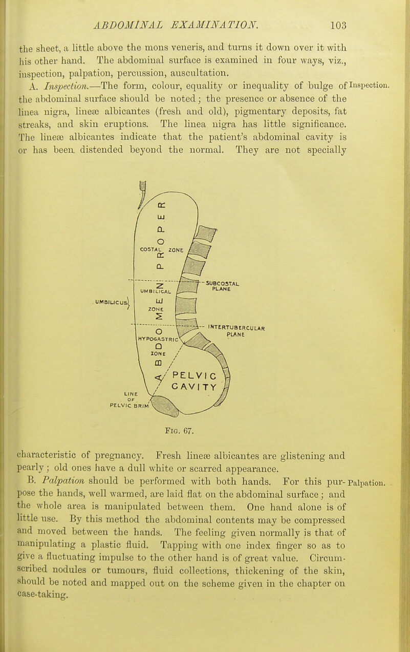 the sheet, a little above the mons veneris, aud turns it down over it with his other hand. The abdominal surface is examined in four ways, viz., inspection, palpation, percussion, auscultation. A. Inspection.—The form, colour, equality or inequality of bulge of Inspection, the abdominal surface should be noted; the presence or absence of the linea nigra, lineee albicantes (fresh and old), pigmentary deposits, fat streaks, and skin eruptions. The linea nigra has little significance. The linea) albicantes indicate that the patient's abdominal cavity is or has been distended beyond the normal. They are not specially Fig. 67. characteristic of pregnancy. Fresh lineee albicantes are glistening and pearly ; old ones have a dull white or scarred appearance. B. Palpation should be performed with both hands. For this pur-palpation, pose the hands, well warmed, are laid flat on the abdominal surface; and the whole area is manipulated between them. One hand alone is of little use. By this method the abdominal contents may be compressed and moved between the hands. The feeling given normally is that of manipulating a plastic fluid. Tapping with one index finger so as to give a fluctuating impulse to the other hand is of great value. Circum- scribed nodules or tumours, fluid collections, thickening of the skin, should be noted and mapped out on the scheme given in the chapter on case-taking.