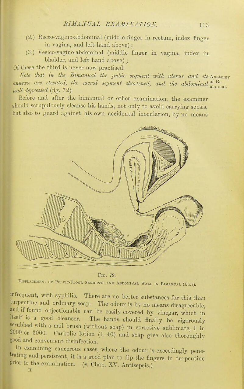 (2.) Recto-vagino-abdomiual (middle finger in rectum, index finger in vagina, and left hand above); (3.) Vesico-vagino-abdominal (middle finger in vagina, index in bladder, and left hand above); Of these the third is never now practised. NoU that in the Bimanual the pubic segment ivith litems and its Axi&iomj annexa are elevated, the sacixd segment shortened, and the <^^dominal°^^:^^T^ wall depressed (fig. 72). Before and after the bimanual or other examination, the examiner should scrupulously cleanse his hands, not only to avoid carrying sepsis, bat also to guard against his own accidental inoculation, by no means Fig. 72. D,SPLACE.MENT OP PeLVIC-FlOOR SEGMENTS AND AbDOMINAL WaLL IN BIMANUAL {RaH). iafrequent, with syphilis. There are no better substances for this than tm7)entine and ordinary soap. The odour is by no means disagreeable, and if found objectionable can be easily covered by vinegar, which in Itself is a good cleanser. The hands should finally be vigorously scrubbed with a nail brush (without soap) in corrosive sublimate, 1 in -000 or 3000. Carbolic lotion (1-40) and soap give also thoroughly good and convenient disinfection. In examining cancerous cases, where the odour is exceedingly pene- tratmg and persistent, it is a good plan to dip the fingers in turpentine pnor to the examination, (v. Chap. XV. Antisepsis.)