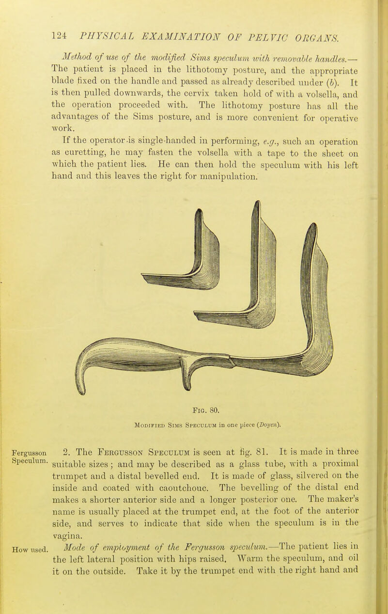 Method of use of the modified Sims speculum with removable handles.— The patient is placed in the lithotomy posture, and the appropriate blade fixed on the handle and passed as already described under (b). It is then pulled downwards, the cervix taken hold of with a volsella, and the operation proceeded with. The lithotomy posture has all the advantages of the Sims posture, and is more convenient for operative work. If the operator-is single-handed in performing, e.(/., such an operation as curetting, he may fasten the volsella with a tape to the sheet on which the patient lies. He can then hold the speculum with his left hand and this leaves the right for manipulation. Fig. 80. Modified Sims Speculum in one piece (Doyen). Fergusson 2. The Fergusson Speculum is seen at fig. 81. It is made in three Speculum, g^^j^j^^jig gjggs; and may be described as a glass tube, with a proximal trumpet and a distal bevelled end. It is made of glass, silvered on the inside and coated with caoutchouc. The bevelling of the distal end makes a shorter anterior side and a longer posterior one. The maker's name is usually placed at the trumpet end, at the foot of the anterior side, and serves to indicate that side when the speculum is in the vagina. How used. Mode of employment of the Fergusson spiecidum.—The patient lies in the left lateral position with hips raised. Warm the speculum, and oil it on the outside. Take it by the trumpet end with the right hand and