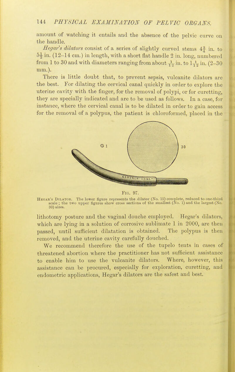 amount of watching it entails and the absence of the pelvic curve on the handle. Hegar's dilators consist of a series of slightly curved stems 4| in. to 5^ in. (12-14 cm.) in length, with a short flat handle 2 in. long, numbered from 1 to 30 and with diameters ranging from about -^^ in. to 1^^2 i- (2-30 mm.). There is little doubt that, to prevent sepsis, vulcanite dilators are the best. For dilating the cervical canal qiiickly in order to explore the uterine cavity with the finger, for the removal of polypi, or for curetting, they are specially indicated and are to be used as follows. In a case, for instance, where the cervical canal is to be dilated in order to gain access for the removal of a polypus, the patient is chloroformed, placed in the Fig. 97. Hegar's Dilator. The lower figure represents the dilator (No. 15) complete, reduced to one-third scale ; the two upper figures show cross sections of the smallest (No. 1) and the largest (No. 30) sizes. lithotomy posture and the vaginal douche employed. Hegar's dilators, which are lying in a solution of corrosive sublimate 1 in 2000, are then passed, until sufficient dilatation is obtained. The polypus is then removed, and the uterine cavity carefully douched. We recommend therefore the use of the tupelo tents in cases of threatened abortion where the practitioner has not sufficient assistance to enable him to use the vulcanite dilators. Where, however, this assistance can be procured, especially for exploration, curetting, and endometric applications, Hegar's dilators are the safest and best.