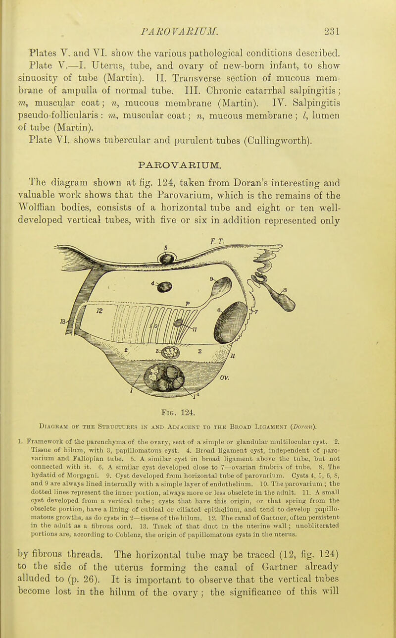 Plates V. and VI. show the various pathological conditions described. Plate V.—I. Uterus, tube, and ovary of new-born infant, to show sinuosity of tube (Martin). 11. Transverse section of mucous mem- brane of ampulla of normal tube. III. Chronic catarrhal salpingitis; m, muscular coat; n, mucous membrane (Martin). IV. SaljDingitis pseudo-follicularis : muscular coat; n, mucous membrane; I, lumen of tube (Martin). Plate VI. shows tubercular and purulent tubes (Cullingworth). PAROVARIUM. The diagram shown at fig. 124, taken from Doran's interesting and valuable work shows that the Parovarium, which is the remains of the Wolffian bodies, consists of a horizontal tube and eight or ten well- developed vertical tubes, with five or six in addition represented only F. T. Fig. 124. Diagram of the Stbttctdres in and Adjacent to the Broad Ligament (Doran). 1. Fr.imework of the pavencliyma of the ovary, seat of a simple or glandular nmltiloonlar cyst. 2. Tissue of hiliim, with 3, papillomatona cyst. 4. Broad ligament cyst, independent of paro- varium and Fallopian tube. 5. A similar cyst in broad ligament above the tube, but not connected with it. C. A similar cyst developed close to 7—ovarian fimbria of tube. S. The hydatid of Morgagni. tl. Cyst developed from horizontal tube of parovarium. Cysts 4, 5, 6, S, and 9 are always lined internally with a aimiile layer of endothelium. 10. The parovarium ; the dotted lines represent the inner poition, always more or less obselete in the adult. 11. A small cyst developed from a vertical tube; cysts that have this origin, or that spring from the obselete ])ort)on, have a lining of cubical or ciliated epithelium, and tend to develop papillo- matous growths, lis do cysts in 2—tissiie of tlie hilum. 12. The canal of Gartner, often persistent in the adult as a fibrous cord. 13. Track of that duct in the uterine wall; unobliterated portions are, according to C'oblenz, the origin of papillomatous cysts in tlie uterus. by fibrous threads. The horizontal tube may be traced (12, fig. 124) to the side of the uterus forming the canal of Gartner already alluded to (p. 26). It is important to observe that the vertical tubes become lost in the hilum of the ovary; the significance of this will