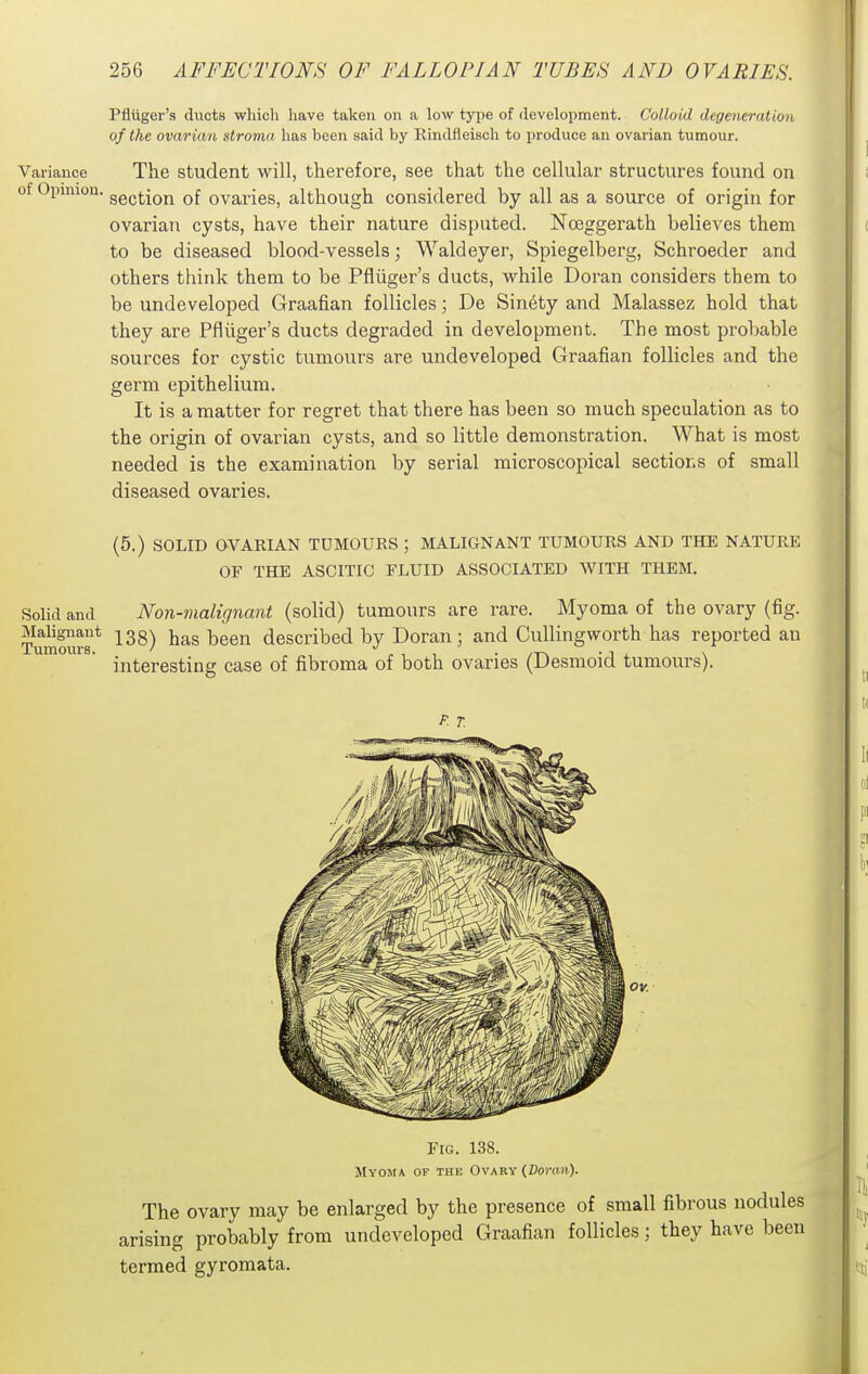 Pfliiger's ducts which liave taken on a low type of development. Colloid degeneration of the ovarian stroma has been said by Rindfleisch to produce an ovarian tumour. Variance The student will, therefore, see that the cellular structures found on of Opmion. ggg(;jQj^ Qf ovaries, although considered by all as a source of origin for ovarian cysts, have their nature disputed. Noeggerath believes them to be diseased blood-vessels; Waldeyer, Spiegelberg, Schroeder and others think them to be Pfliiger's ducts, while Doran considers them to be undeveloped Graafian follicles; De Sin6ty and Malassez hold that they are Pfliiger's ducts degraded in development. The most probable sources for cystic tumours are undeveloped Graafian follicles and the germ epithelium. It is a matter for regret that there has been so much speculation as to the origin of ovarian cysts, and so little demonstration. What is most needed is the examination by serial microscopical sections of small diseased ovaries. (5.) SOLID OVARIAN TUMOURS ; MALIGNANT TUMOURS AND THE NATURE OF THE ASCITIC FLUID ASSOCIATED WITH THEM. Solid and Non-malignant (solid) tumours are rare. Myoma of the ovary (fig. Turner* ^^^) ^^^^ described by Doran; and CuUingworth has reported an interesting case of fibroma of both ovaries (Desmoid tumours). F. T. Fig. 138. Myoma of the Ovary (Do?-o»). The ovary may be enlarged by the presence of small fibrous nodules arising probably from undeveloped Graafian follicles; they have been termed gyromata.