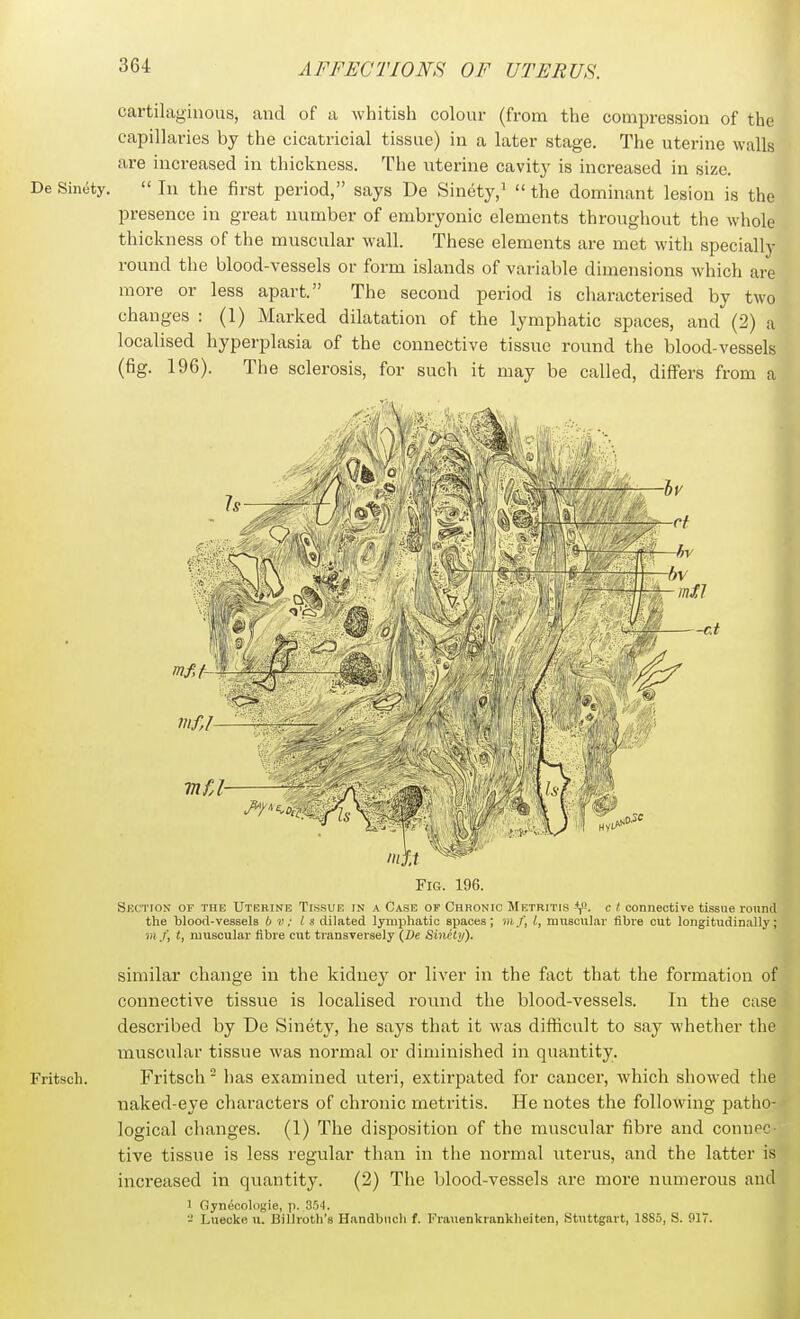 cartilaginous, and of a whitish colour (from the compression of the capillaries by the cicatricial tissue) in a later stage. The uterine walls are increased in thickness. The uterine cavit}' is increased in size. De Sin(5ty.  In the first period, says De Sinety,'  the dominant lesion is the presence in great number of embryonic elements throughout the whole thickness of the muscular wall. These elements are met with specially round the blood-vessels or form islands of variable dimensions which are more or less apart. The second period is characterised by two changes : (1) Marked dilatation of the lymphatic spaces, and (2) a localised hyperplasia of the connective tissue rovmd the blood-vessels (fig. 196). The sclerosis, for such it may be called, differs from a Fig. 196. Suction of the Uterine Tissue in a Case of Chronic Metritis c I- connective tissue round the blood-vessels b v; I s dilated lymphatic spaces; vif, I, muscular fibre cut longitudinally; m j, t, muscular fibre cut transversely (De Sinctij). similar change in the kidney or liver in the fact that the formation of connective tissue is localised round the blood-vessels. In the case described by De Sinety, he says that it was difficult to say whether the muscular tissue was normal or diminished in quantity. Fritscli. Fritsch has examined uteri, extirpated for cancer, which showed the naked-eye characters of chronic metritis. He notes the following patho- logical changes. (1) The disposition of the muscular fibre and connec- tive tissue is less regular than in the normal uterus, and the latter is increased in quantity. (2) Tiie blood-vessels are more numerous and 5 Gyn&ologie, p. SS). - Luecke u. Billroth's Handbuch f. Frauenkrankheiten, Stuttgart, 18S5, S. 917.