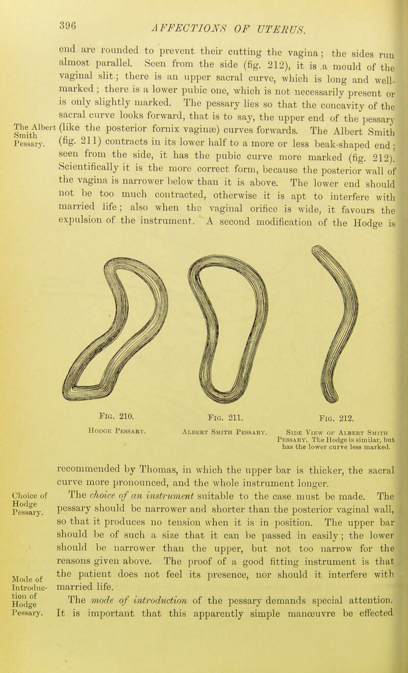 end are rounded to prevent their cutting the vagina; the sides n... almost parallel. Seen from the side (fig. 212), it is .a mould of the vaginal slit; there is an upper sacral curve, which is long and well- marked ; there is a lower pubic one, which is not necessarily present or is only slightly marked. The pessary lies so that the concavity of the sacral curve looks forward, that is to say, the upper end of the pessary Smith^'''* ^^^^^^ posterior fornix vaginee) curves forwards. The Albert Smith Pessary, (^g- ^H) contracts in its lower half to a more or less beak-shaped end • seen from the side, it has the pubic curve more marked (fig. 212)! Scientifically it is the more correct form, because the posterior wall of the vagma is narrower below than it is above. The lower end should not be too much contracted, otherwise it is apt to interfere with married life; also when the vaginal orifice is wMde, it favours the expulsion of the instrument. A second modification of the Hodge is Choice of Hodge Pessarj'. I\ro(le of Introduc- tion of Hodge PeHsary. Fig. 210. Hodge Pessarv. Fig. 211. Albert Smith Pkssary. Fig. 212. Side View of Albert Smith Pessary. Tlie llodge is similar, but has the lower curve less marked. recommended by Thomas, in which the upper bar is thicker, the sacral curve more pronounced, and the whole instrument longer. The cJioice of an instrument suitable to the case must be made. The pessary should be narrower and shorter than the posterior vaginal wall, so that it produces no tension when it is in position. The upper bar should be of such a size that it can be passed in easily ; the lower should be narrower than the upper, but not too narrow for the reasons given above. The proof of a good fitting instrument is that the patient does not feel its i^resence, nor should it interfere with married life. The mode of introduction of the pessaiy demands special attention. It is important that this apparently simple manoeuvre be effected