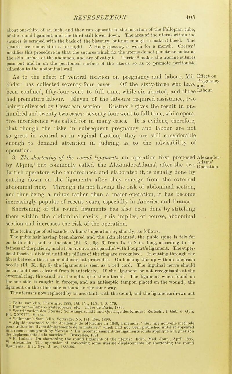 aljout one-third of an inch, and they run opposite to the insertion of the Fallopian tube, of tlie round ligament, and the third still lower down. The area of the uterus within the sutures is scrajied with the back of the bistoury, but not enough to make it bleed. The sutures are removed in a fortnight. A Hodge pes.sary is worn for a mouth. Czernyi modifies this procedure in that the sutures which fix the uterus do not penetrate as far as the skin surface of the abdomen, and are of catgut. Terrier - makes the uterine sutures pass out and in on the peritoneal surface of the uterus so as to promote peritonitic adhesion to the abdominal wall. As to the effect of ventral fixation on pregnancy and labour, Mil-Effect on ander ^ has collected seventy-four cases. Of the sixty-three who have and^''^''^ been confined, fifty-four went to full time, while six aborted, and three Labour, liad premature labour. Eleven of the labours required assistance, two being delivered by Csesarean section. Kiistner* gives the result in one hundred and twenty-two cases: seventy-four went to full time, while opera- tive interference was called for in many cases. It is evident, therefore, that though the risks in subsequent pregnancy and laboiir are not so great in ventral as in vaginal fixation, they are still considerable enough to demand attention in judging as to the advisability of operation. 3. The shortening of the round ligaments, an operation first proposed Alexander- by Alquie, but commonly called the Alexander-Adams', after the two Operation. British ojaerators who reintroduced and elaborated it, is usually done hj cutting down on the ligaments after they emerge from the external abdominal ritig. Through its not having the risk of abdominal section, and thus being a minor rather than a major operation, it has become increasingly popular of recent years, especially in America and France. Shortening of the round ligaments has also been done by stitching them within the abdominal cavity ; this implies, of course, abdominal section and increases the risk of the operation. The technique of Alexander-Adams' ^ operation is, shortly, as follows. The pubic hair having been shaved and the skin cleansed, the pubic spine is felt for on both sides, and an incision (PI. X., fig. 6) from I3 to 2 in. long, according to the fatness of the patient, made from it outwards parallel with Poupart's ligament. The super- ficial fascia is divided until the pillars of the ring are recognised. In cutting through the fibres between these some delicate fat protrudes. On hooking this up with an aneurism needle (PI. X., fig. 6) the ligament is seen as a red cord. The inguinal nerve should be cut and fascia cleared from it anteriorly. If the ligament be not recognisable at the external ring, the canal can be split up to the internal. The ligament when found on the one side is caught in forceps, and an antiseptic tampon placed on the wound; the ligament on the other side is found in the same way. The uterus is now replaced by an assistant, with the sound, and the ligaments drawn out 1 Beitr. ziir klin. Chinngie, 1888, Bd. IV., Hft. 1, S. 179. Dumoret—Lapiuo-hysteropexie, etc. Tliese de Paris, 1889. Ventrifixation des Uterua ; Scliwangerschaft and Querlage des Klndes : Zeitschr. f. Geb. n. Gyn. Bd. XXXIII., S. 464. * Volkrnann's Sam. klin. Vortriige, No. 171, Dec. 1896. 5 AUpiii; presented to the AcadiSmie de Mddecine in 1840, a memoir, Siir nne nouvelle miSthode pour traiter les divers deplacements de la niatrice, which had not been published until it appeared in a recent monograph by Morean,  Du raccoureissement des ligaments ronds appliqiu) ii la gui5rison des deplacements de la matrice. Bruxelles, 1894. 8 F. Imlach—On shortening the round ligament of the nterus: Bdin. Jled. Jour., April 1885. W. Alexander—The operation of conecting some uterine disijlacements by shortening the round ligaments: Uiit. Gyn. .lonr., 188.0-80.