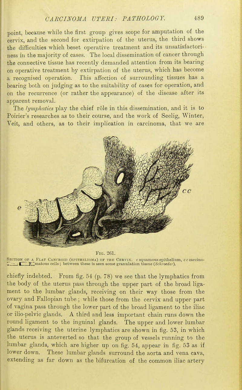 point, because while the first group gives scope for amputation of the cervix, and the second for extirpation of the uterus, the third shows the difficulties which beset operative treatment and its unsatisfactori- ness in the majority of cases. The local dissemination of cancer through the connective tissue has recently demanded attention from its bearing on operative treatment by extirpation of the uterus, which has become a recognised operation. This aflfection of surrounding tissues has a bearing both on judging as to the suitability of cases for operation, and on the recurrence (or rather the appearance) of the disease after its apparent removal. The lymphatics play the chief role in this dissemination, and it is to Poirier's researches as to their course, and the work of Seelig, Winter, Veit, and others, as to their implication in carcinoma, that we are Fig. 261. Section of a Flat Cancroid (epithelioma) of the Cervix, c squamous epithelium, cccaicino- TT - 11 ~g;^matonB cells; between these is seen some granulation tissue (Schroeder). chiefly indebted. From fig. 54 (p. 78) we see that the lymphatics from the body of the uterus pass through the upper part of the broad liga- ment to the lumbar glands, receiving on their way those from the ovary and Fallopian tube ; Avhile those from the cervix and upper part of vagina pass through the lower part of the broad ligament to the iliac or ilio-pelvic glands. A third and less important chain runs down the round ligament to the inguinal glands. The upper and lower lumbar glands receiving the uterine lymphatics are shown in fig. 53, in which the uterus is anteverted so that the group of vessels running to the lumbar glands, which are higher up on fig. 54, appear in fig. 53 as if lower down. These lumbar glands surround the aorta and vena cava, extending as far down as the bifurcation of the common iliac artery