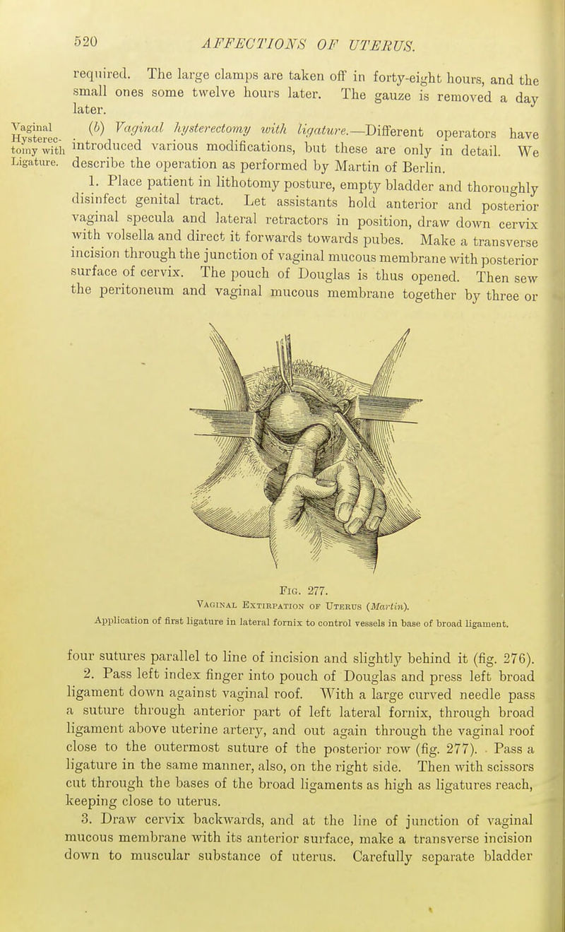 required. The large clamps are taken off in forty-eight hours, and the small ones some twelve hours later. The gauze is removed a day later. (6) Vaginal hysterectomy ivith %ai!M?-e.—Different operators have introduced various modifications, but these are only in detail. We describe the operation as performed by Martin of Berlin. 1. Place patient in lithotomy posture, empty bladder and thoroughly disinfect genital tract. Let assistants hold anterior and posterior vaginal specula and lateral retractors in position, draw down cervix with volsella and direct it forwards towards pubes. Make a transverse incision through the junction of vaginal mucous membrane with posterior surface of cervix. The pouch of Douglas is thus opened. Then sew the peritoneum and vaginal mucous membrane together by three or Fig. 277. Vaginal Extirpation of Uterus {Martin). Application of first ligature in lateral fornix to control vessels in base of broad ligament. four sutures parallel to line of incision and slightly behind it (fig. 276). 2. Pass left index finger into pouch of Douglas and press left broad ligament down against vaginal roof. With a large curved needle pass a suture through anterior part of left lateral fornix, through broad ligament above uterine artery, and out again through the vaginal roof close to the outermost suture of the posterior row (fig. 277). Pass a ligature in the same manner, also, on the right side. Then with scissors cut through the bases of the broad ligaments as high as ligatures reach, keeping close to uterus. 3. Draw cervix backwards, and at the line of junction of vaginal mucous membrane with its anterior surface, make a transverse incision down to muscular substance of uterus. Carefully separate bladder