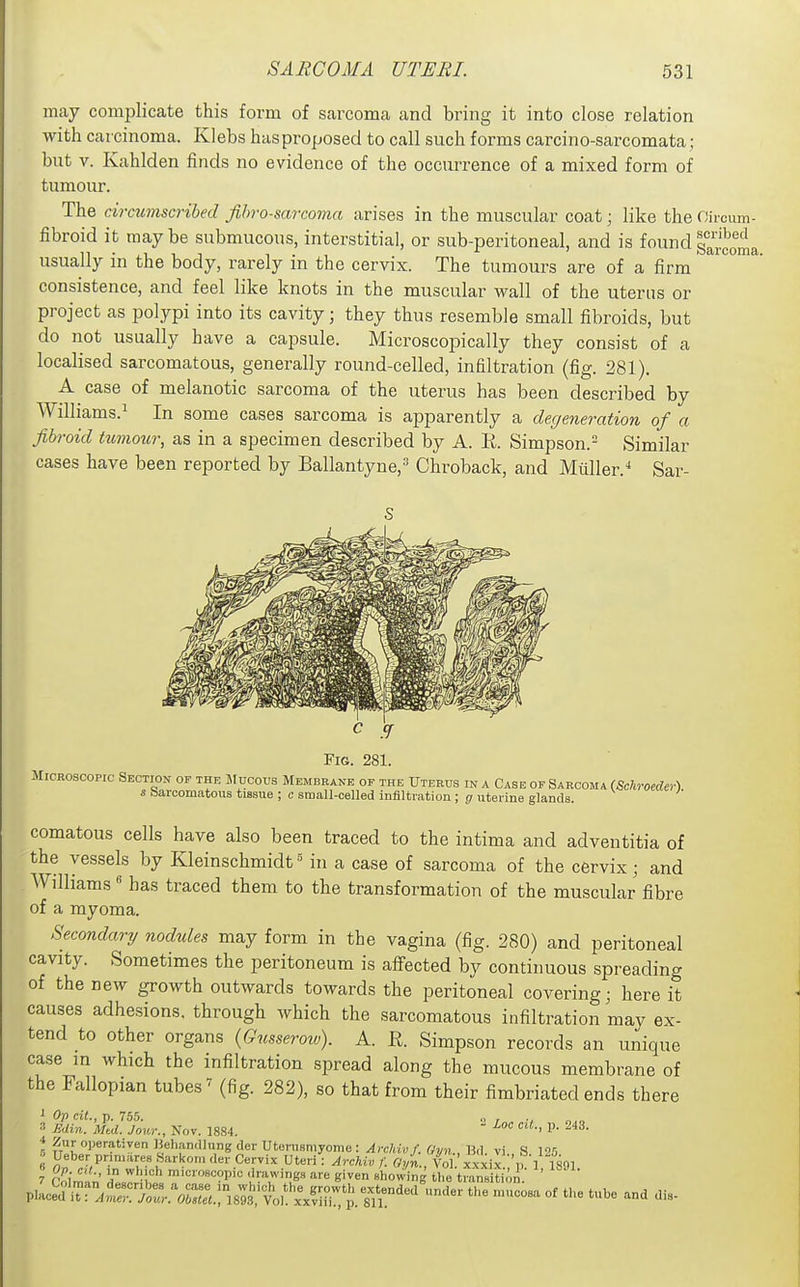 may complicate this form of sarcoma and bring it into close relation with carcinoma. Klebs hasproposed to call such forms carcino-sarcomata; but V. Kahlden finds no evidence of the occurrence of a mixed form of tumour. The circumscribed fibrosarcoma arises in the muscular coat; like the Oircum- fibroid it maybe submucous, interstitial, or sub-peritoneal, and is founds;!^^'',^^ usually in the body, rarely in the cervix. The tumours are of a firm consistence, and feel like knots in the muscular wall of the uterus or project as polypi into its cavity; they thus resemble small fibroids, but do not usually have a capsule. Microscopically they consist of a localised sarcomatous, generally round-celled, infiltration (fig. 281). A case of melanotic sarcoma of the uterus has been described by Williams.^ In some cases sarcoma is apparently a degeneration of a fibroid ttmour, as in a specimen described by A. E. Simpson.^ Similar cases have been reported by Ballantyne,^ Chroback, and Miiller.^ Sar- FiG. 281. Microscopic Section of the Mucous Membrane of the Uterus in a Case of Sarcoma (Schroeder) s barcomatous tissue ; c small-celled infiltration ; g uterine glands. comatous cells have also been traced to the intima and adventitia of the vessels by Kleinschmidtin a case of sarcoma of the cervix; and Williams' has traced them to the transformation of the muscular fibre of a myoma. Secondary nodules may form in the vagina (fig. 280) and peritoneal cavity. Sometimes the peritoneum is afi-ected by continuous spreading of the new growth outwards towards the peritoneal covering; here it causes adhesions, through which the sarcomatous infiltration may ex- tend to other organs {Gusseroiv). A. R. Simpson records an unique case in which the infiltration spread along the mucous membrane of the Fallopian tubes ^ (fig. 282), so that from their fimbriated ends there  hoc cil., 1). 243. i Op cil., p. 755. Min. Mtd. Jour., Nov. 1884. 4 Zur operativen Behandlung der Utenismyome : ArcUv f. Gyn., Bd vi S 125 ■' Ueber primaresSarkom der Cervix Uteri: Archiv f. Gyn., Vol.xxxix 'p'] 1891 7 r% ' ''i;''' '■•'««91<= 'irawings are given showing the trans t .n p.:c^d\Tr.„t!tr.s.;i^ —^-^^ -d dis.