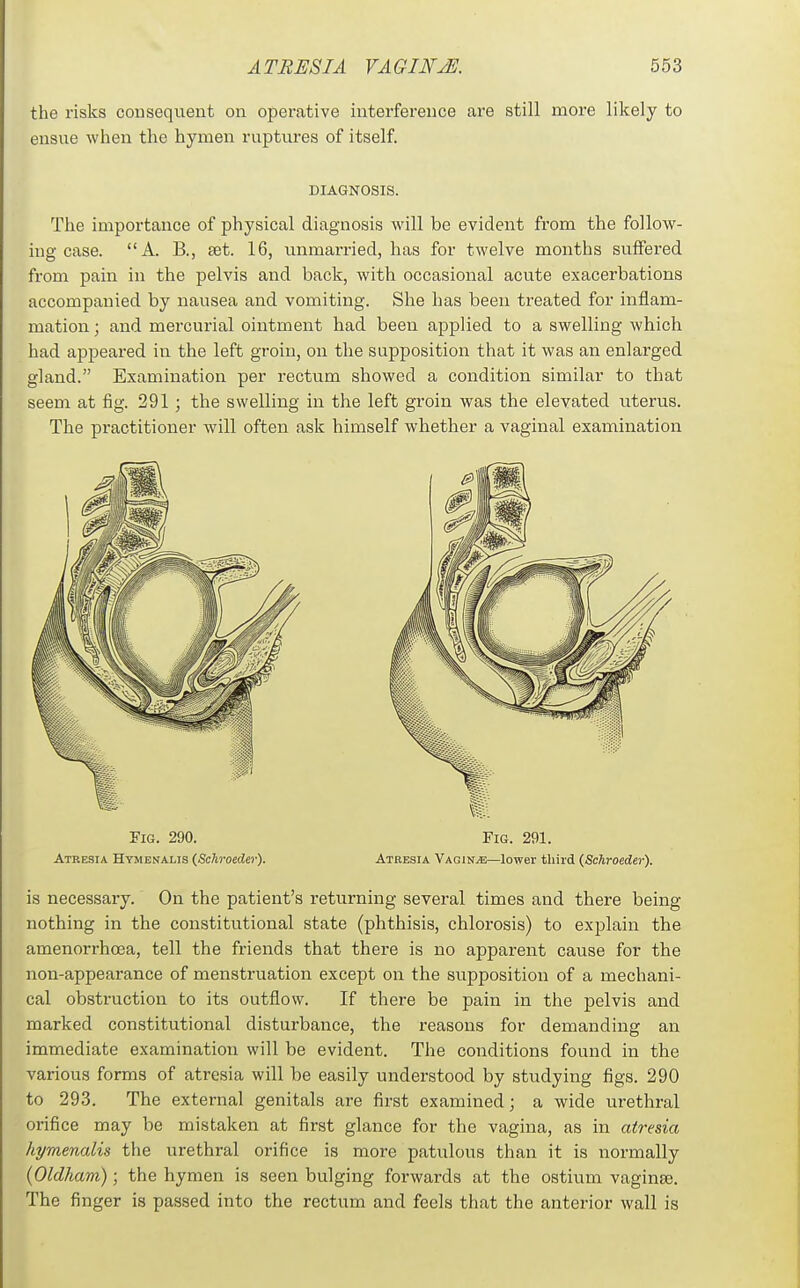 the risks consequent on operative interference are still more likely to ensue when the hymen ruptures of itself DIAGNOSIS. The importance of physical diagnosis will be evident from the follow- ing case. A. B., tet. 16, unmarried, has for twelve months suffered from pain in the pelvis and back, with occasional acute exacerbations accompanied by nausea and vomiting. She has been treated for inflam- mation ; and mercurial ointment had been applied to a swelling which had appeared in the left groin, on the supposition that it was an enlarged gland. Examination per rectum showed a condition similar to that seem at fig. 291 ; the swelling in the left gi'oin was the elevated uterus. The practitioner will often ask himself whether a vaginal examination Fig. 290. Fig. 291. Atresia Htmenalis (Schroeder). Atresia Vaginae—lower third (Schroeder). is necessary. On the patient's returning several times and there being- nothing in the constitutional state (phthisis, chlorosis) to explain the amenorrhoea, tell the friends that there is no apparent cause for the non-appearance of menstruation except on the supposition of a mechani- cal obstruction to its outflow. If there be pain in the pelvis and marked constitutional disturbance, the reasons for demanding an immediate examination will be evident. The conditions found in the various forms of atresia will be easily understood by studying figs. 290 to 293. The external genitals are first examined; a wide urethral orifice may be mistaken at first glance for the vagina, as in atresia hymenalis the urethral orifice is more patulous than it is normally {Oldham); the hymen is seen bulging forwards at the ostium vaginae. The finger is passed into the rectum and feels that the anterior wall is