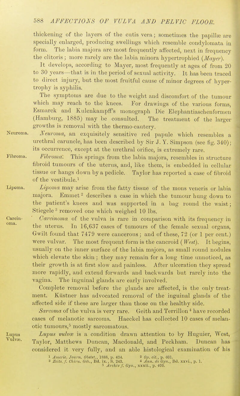 Neuroma. Fibroma. Lipoma. Carcin- oma. Lupus Vulvpe. thickening of the layers of the cutis vera; sometimes the papilltc are specially enlarged, producing swellings which resemble condylomata in form. The labia majora are most frequently aft'ected, next in frequency the clitoris; more rarely are the labia minora hypertrophied {Mayer). It develops, according to Mayer, most frequently at ages of from 20 to 30 years—that is in the period of sexual activity. It has been traced to direct injury, but the most fruitful cause of minor degrees of hyper- trophy is syphilis. The symptoms are due to the weight and discomfort of the tumour which may reach to the knees. For drawings of the various forms, Esmarck and Kulenkampff's monograph Die Elephantiaschenformen (Hamburg, 1885) may be consulted. The treatment of the larger growths is removal with the thermo-cautery. Neuroma, an exquisitely sensitive red papule which resembles a urethral caruncle, has been described by Sir J. Y. Simpson (see fig. 340); its occurrence, except at the urethral orifice, is extremely rare. Fibroma. This springs from the labia majora, resembles in structure fibroid tumours of the uterus, and, like them, is embedded in cellular tissue or hangs down by a pedicle. Taylor has reported a case of fibroid of the vestibule.^ Lipoma may arise from the fatty tissue of the mons veneris or labia majora. Emmet ^ describes a case in which the tumour hung down to the patient's knees and was supported in a bag round the waist; Stiegele^ removed one which weighed 10 lbs. Carcinoma of the vulva is rare in comparison with its frequeuc}^ in the uterus. In 16,637 cases of tumours of the female sexual organs, Gwilt found that 7479 were cancerous; and of these, 72 (or 1 per cent.) were vulvar. The most frequent form is the cancroid ( West). It begins, usually on the inner surface of the labia majora, as small i-ound nodules which elevate the skin; they may remain for a long time unnoticed, as their growth is at first slow and painless. After ulceration they spread more rapidly, and extend forwards and backwards but rarely into the vagina. The inguinal glands are early involved. Complete removal before the glands are affected, is the only treat- ment. Kiistner has advocated removal of the inguinal glands of the affected side if these are larger than those on the healthy side. Sarcoma of the vulva is very rare. Geith and Terrillon have recorded cases of melanotic sarcoma. Haeckel has collected 10 cases of melan- otic tumours,'' mostly sarcomatous. Lupus vulvas is a condition drawn attention to by Huguier, West, Taylor, Matthews Duncan, Macdonald, and Peckham. Duncan has considered it very fully, and an able histological examination of his 1 Americ. Jouvn. Obsiet., 1S88, p. 434.  Op. cit., p. 601. •i Zeits. /. Ckiru. Ueb., Bd. ix., S. 243. 4 Ann. dc Oi/n., lid. xxvi., p. 1. 5 Arcliiv f. Gyn., xxxii., p. 400.