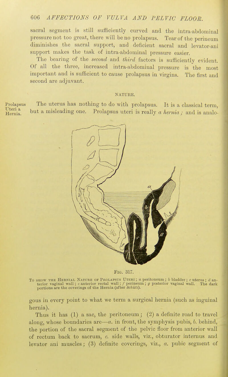 sacral segment is still sufficiently curved and the intra-abdominal pressure not too great, there will be no prolapsus. Tear of the perineum diminishes the sacral support, and deficient sacral and levator-ani support makes the task of intra-abdominal pressure easier. The bearing of the second and third factors is sufficiently evident. Of all the three, increased intra-abdominal pressure is the most important and is sufficient to cause prolapsus in virgins. The first and second are adjuvant. NATURE. Prolapsus The uterus has nothing to do with prolapsus. It is a classical term. Hernia. ^ misleading one. Prolapsus uteri is really a hernia ; and is analo- FiG. 317. To SHOW THE Hernial Natpre of Prolapsus Uteri ; a peritoneum ; b bladder ; c uterne ; d an- terior vaginal wall ; e anterior rectal wall; /' perineum; g i^osterior vaginal wall. The dark portions are the coverings of the Hernia (after Schiilz). gous in every point to what we term a surgical hernia (such as inguinal hernia). Thus it has (1) a sac, the peritoneum; (2) a definite road to travel along, whose boundaries are—a. in front, the symphysis pubis, b. behind, the portion of the sacral segment of the pelvic floor from anterior wall of rectum back to sacrum, c. side walls, viz., obturator iuteruus and levator ani muscles; (3) definite coverings, viz., a. pubic segment of