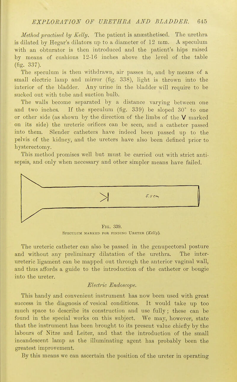 Method practised ly Kelly. The patient is aneesthetised. The urethra is dilated by Hegar's dilators up to a diameter of 12 mm. A speculum with an obturator is then introduced and the patient's hips raised by means of cushions 12-16 inches above the level of the table (fig. 337). The speculum is then withdrawn, air passes in, and by means of a small electric lamp and mirror (fig. 338), light is thrown into the interior of the bladder. Any urine in the bladder will require to be sucked out with tube and suction bulb. The walls become separated by a distance varying between one and two inches. If the speculum (fig. 339) be sloped 30° to one or other side (as shown by the direction of the limbs of the V mai-ked on its side) the ureteric orifices can be seen, and a catheter passed into them. Slender catheters have indeed been passed up to the pelvis of the kidney, and the ureters have also been defined prior to hysterectomy. This method promises well but must be carried out with strict anti- sepsis, and only when necessary and other simpler means have failed. Fig. 339. Speculum marked for finding Ureter (Kelly). The lu-eteric catheter can also be passed in the genupectoral posture and without any preliminary dilatation of the urethra. The inter- ureteric ligament can be mapped out through the anterior vaginal wall, and thus affords a guide to the introduction of the catheter or bougie into the ureter. Electric Endoscope. This handy and convenient instrument has now been used with great success in the diagnosis of vesical conditions. It would take up too much space to describe its construction and use fully; these can be found in the special works on this subject. We may, however, state that the instrument has been brought to its present value chiefly by the labours of Nitze and Leiter, and that the introduction of the small incandescent lamp as the illuminating agent has probably been the greatest improvement. By this means we can ascertain the position of the ureter in operating