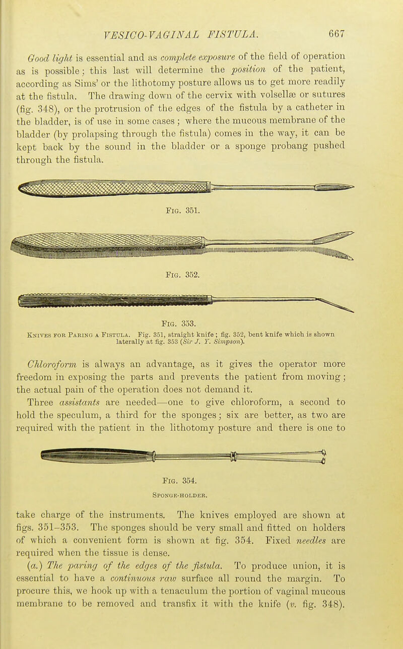 Good light is essential and as complete exposure of the field of operation as is possible; this last will determine the position of the patient, according as Sims' or the lithotomy posture allows us to get more readily at the fistula. The drawing down of the cervix with volsellee or sutures (fig. 348), or the protrusion of tlie edges of the fistiTla by a catheter in the bladder, is of use in some cases ; where the mucous membrane of the bladder (by prolapsing through the fistula) comes in the way, it can be kept back by tlie sound in the bladder or a sponge probang pushed through the fistula. Fig. 353. Knives for Paring a Fistula. Fig. 351, straight knife ; fig. 352, bent knife which is shown laterally at fig. 353 (Sir /. Y. Simpson). Chloroform is always an advantage, as it gives the operator more freedom in exposing the parts and prevents the patient from moving; the actual pain of the operation does not demand it. Three assistants are needed—one to give chloroform, a second to hold the speculum, a third for the sponges; six are better, as two are required with the patient in the lithotomy posture and there is one to Fig. 354. Sponoe-holder. take charge of the instruments. The knives employed are shown at figs. 351-353. The sponges should be very small and fitted on holders of which a convenient form is shown at fig. 354. Fixed needles are required when the tissue is dense. (a.) The paring of the edges of the ji,^tula. To produce union, it is essential to have a continuous raiv surface all round the margin. To procure this, we hook up with a tenaculum the portion of vaginal mucous membrane to be removed and transfix it with the knife {v. fig. 348).