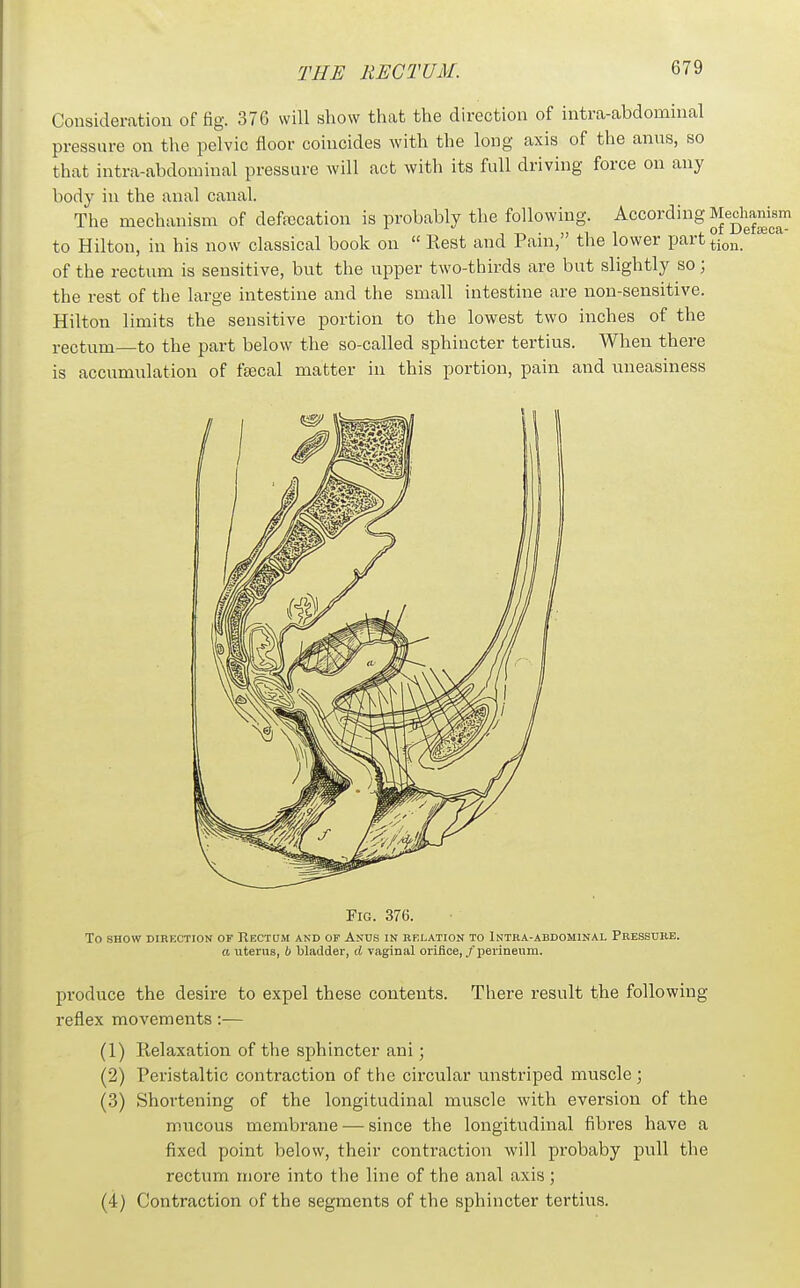 Consideration of fig. 376 will show that the direction of intra-abdominal pressure on the pelvic floor coincides with the long axis of the anus, so that intra-abdominal pressure will act with its full driving force on any body in the anal canal. The mechanism of deffecation is probably the following. According Mechanism to Hilton, in his now classical book on  Rest and Pain, the lower part^j^j^ of the rectum is sensitive, but the upper two-thirds are but slightly so; the rest of the large intestine and the small intestine are non-sensitive. Hilton limits the sensitive portion to the lowest two inches of the rectum—to the part below the so-called sphincter tertius. When there is accumulation of fsecal matter in this portion, pain and uneasiness Fig. 376. To SHOW DIRECTION OF KeCTUM AND OF AnUS IN RELATION TO INTRA-ABDOMINAL PRESSURE. a uterus, b bladder, d vaginal orifice, / perineum. produce the desire to expel these contents. There result the following reflex movements :— (1) Relaxation of the sphincter ani; (2) Peristaltic contraction of the circular unstriped muscle; (.3) Shortening of the longitudinal muscle with eversion of the mucous membrane •—• since the longitudinal fibres have a fixed point below, their contraction will probaby pull the rectum more into the line of the anal axis; (4) Contraction of the segments of the sphincter tertius.