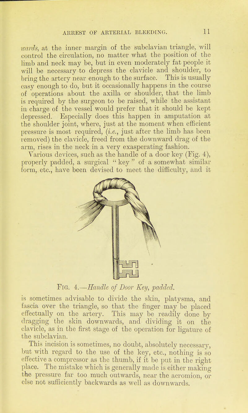 wards, at the inner margin of the subclavian triangle, will control the circulation, no matter what the position of the limb and neck may be, but in even moderately fat people it will be necessary to depress the clavicle and shoulder, to bring the artery near enough to the surface. This is usually easy enough to do, but it occasionally happens in the course of operations about the axilla or shoulder, that the limb is required by the surgeon to be raised, while the assistant in charge of the vessel would prefer that it should be kept depressed. Especially does this happen in amputation at the shoulder joint, where, just at the moment when efficient pressure is most required, {i.e., just after the limb has been removed) the clavicle, freed from the downward drag of the arm, rises in the neck in a very exaspei-ating fashion. Various devices, such as the handle of a door key (Fig. 4), properly padded, a surgical key of a someAvhat similar form, etc., have been devised to meet the difficulty, and it Fig. 4.—Handle of Door Key, padded. is sometimes advisable to divide the skin, platysma, and fascia over the triangle, so that the finger may be placed effectually on the arter3^ This may be readily done by dragging the skin downwards, and dividing it on the clavicle, as in the first stage of the operation for ligature of the subclavian. This incision is sometimes, no doubt, absolutely neccssarj^, Imt with regard to the use of the key, etc., nothing is so effective a compressor as the thumb, if it be put in the right place. The mistake which is generally made is either making the pressure far too much outwards, near the acromion, or else not sufficiently backwards as well as downwards.