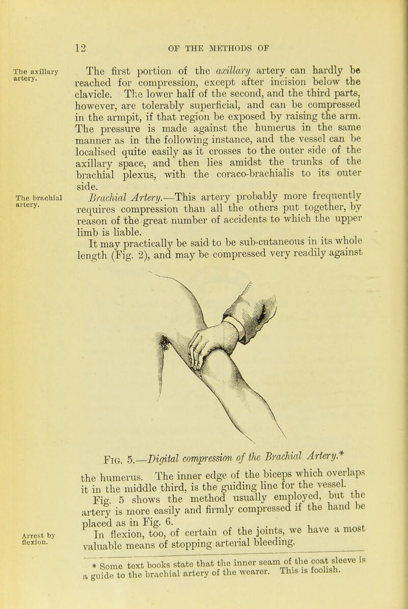 The axillary The first portion of the axillary artery can hardly be artery. reached for compression, except after incision below the clavicle. Tl^.e lower half of the second, and the third parts, however, are tolerably superficial, and can be compressed in the armpit, if that region be exposed by raising the arm. The pressure is made against the humerus in the same manner as in the following instance, and the vessel can be localised quite easily as it crosses to the outer side of the axillary space, and then lies amidst the trunks of the brachial plexus, with the coraco-brachialis to its outer side. The brachial Brachial Artery.—This artery probably more frequently requires compression than all the others put together, by reason of the great number of accidents to which the upper limb is liable. It may practically be said to be sub-cutaneous in its whole length (Fig. 2), and may be compressed very readily against Arrest by Fig. 5.—Digital comp-essim of the Brachial Artery* the humerus. The inner edge of the biceps which overlaps it in the middle third, is the guiding line for the vessel. Fig 5 shows the method usually employed, but the artery is more easily and firmly compressed if the hand be placed as in Fig. 6. In flexion, too, of certain of the joints, we have a most valuable means of stopping arterial bleeding. ' ♦Some te^rtb^^kT^t^hat the inner seam of the co«.t sleeve is a guide to the brachial artery of the wearer. This is foohsh.