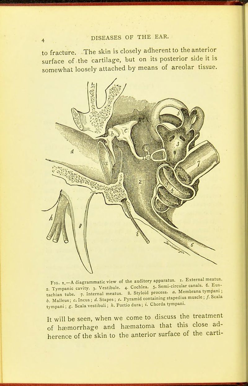 to fracture. The skin is closely adherent to the anterior surface of-the cartilage, but on its posterior side it is somewhat loosely attached by means of areolar tissue. Fig. I -A diagrammatic view of the auditory apparatus, i. External meatus. 2. Tymp'anic cavity. 3. Vestibule. 4- Cochlea. 5. Semi-circular canals 6. Eus- tachian tube. 7- Internal meatus. 8. Styloid process. «. Membrana tympam b Malleus; c. Incus ; d. Stapes; e. Pyramid containing stapedius muscle ;/. Scala tympani; g. Scala vestibuli; h. Portiodura; i. Chorda tympam. It will be seen, when we come to discuss the treatment of hemorrhage and haematoma that this close ad- herence of the skin to the anterior surface of the carti-