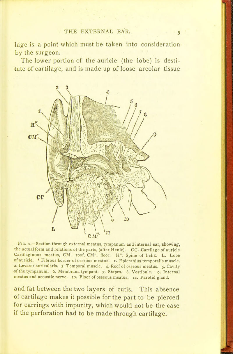 THE EXTERNAL EAR. lage is a point which must be talcen into consideration by the surgeon. The lower portion of the auricle (the lobe) is desti- tute of cartilage, and is made up of loose areolar tissue a 3 \ \ 4 Fig. 2.—Section through external meatus, tympanum and internal ear, showing, the actual form and relations of the parts, (after Henle). CC. Cartilage of auricle Cartilaginous meatus, CM', roof, CM, floor. H. Spine of helix. L. Lobe of auricle. * Fibrous border of osseous meatus, i. Epicranius temporalis muscle. 2. Levator auricularis. 3. Temporal muscle. 4. Roof of osseous meatus. 5. Cavity of the tympanum. 6. Membrana tympani. 7. Stapes. 8. Vestibule, g. Internal meatus and acoustic nerve. 10. Floor of osseous meatus. 11. Parotid gland. and fat between the two layers of cutis. This absence of cartilage makes it possible for the part to be pierced for earrings with impunity, which would not be the case if the perforation had to be made through cartilage.