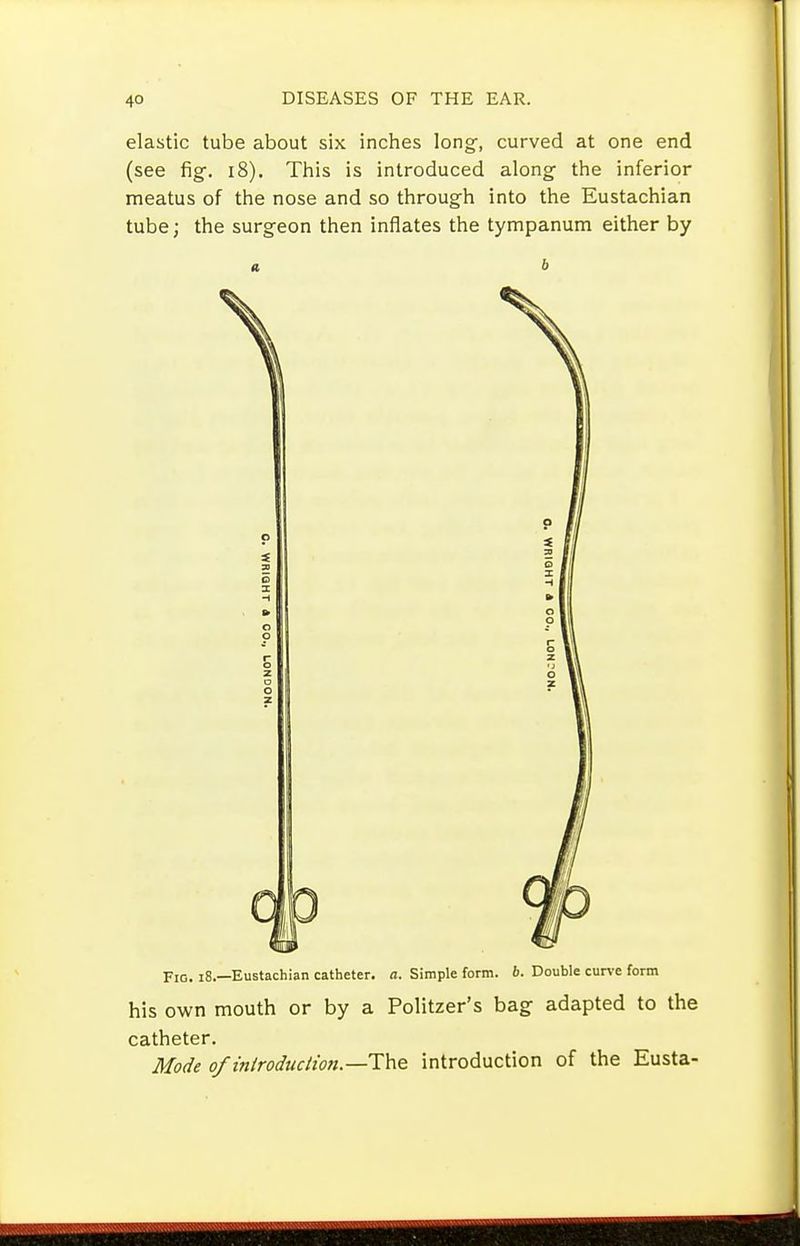 elastic tube about six inches long, curved at one end (see fig. i8). This is introduced along the inferior meatus of the nose and so through into the Eustachian tube; the surgeon then inflates the tympanum either by Fig. i8.—Eustachian catheter, a. Simple form. b. Double curve form his own mouth or by a Politzer's bag adapted to the catheter. Mode o/m/roduch'on.—The introduction of the Eusta-