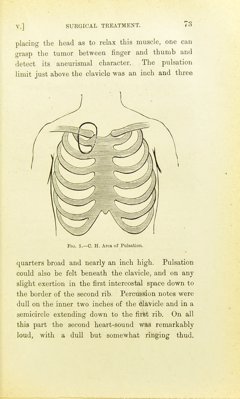 placing the head as to relax this muscle, one can grasp the tumor between finger and thumb and detect its aneurismal character. The pulsation limit just above the clavicle was an inch and three Fig. 5.—C. H. Area of Pulsation. quarters broad and nearly an inch high. Pulsation could also be felt beneath the clavicle, and on any slight exertion in the first intercostal space down to the border of the second rib. Percussion notes were dull on the inner two inches of the <5lavicle and in a semicircle extending down to the firfet rib. On all this part the second heart-sound was remarkably loud, with a dull but somewhat ringing thud.