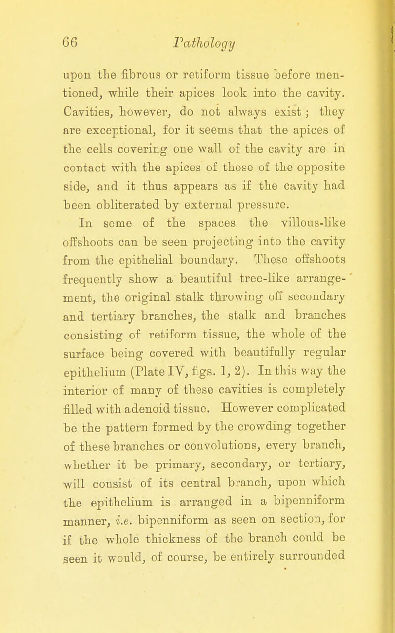 upon the fibrous or retiform tissue before men- tioned, wliile their apices look into the cavity. Cavities, however, do not always exist; they are exceptional, for it seems that the apices of the cells covering one wall of the cavity are in contact with the apices of those of the opposite side, and it thus appears as if the cavity had been obliterated by external pressure. In seme of the spaces the villous-like oifshoots can be seen projecting into the cavity from the epithelial boundary. These offshoots frequently show a beautiful tree-like arrange- ment, the original stalk throwing off secondary and tertiary branches, the stalk and branches consisting of retiform tissue, the whole of the surface being covered with beautifully regular epithelium (Plate IV, figs. 1, 2). In this way the interior of many of these cavities is completely filled with adenoid tissue. However complicated be the pattern formed by the crowding together of these branches or convolutions, every branch, whether it be primary, secondary, or tertiary, will consist of its central branch, upon which the epithelium is arranged in a bipenniform manner, i.e. bipenniform as seen on section, for if the whole thickness of the branch could be seen it would, of course, be entirely surrounded