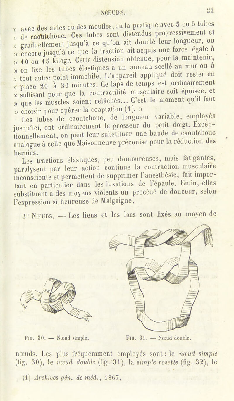 . avec des aides ou des moufles, on la pratique avec 5 ou 6 tubes „ de caolitchouc. Ces tubes sont distendus progressivement et n graduellement jusqu'à ce qu'on ait doublé leur ongueur ou ,, encore jusqu'à ce que la traction ait acquis une force égale a ,) 10 ou 15 kilogr. Celte distension obtenue, pour la ma-ntenir, » on fixe les tubes élastiques à un anneau scellé au mur ou a >) tout autre point immobile. L'appareil appliqué doit rester en » place 20 à 30 minutes. Ce laps de temps est ordinairement « suffisant pour que la contractililé musculaire soit épmsee, et » que les muscles soient relâchés... C'est le moment qu'il faut » choisir pour opérer la coaptation (1). » Les tubes de caoutchouc, de longueur variable, employés jusqu'ici, ont ordinairement la grosseur du petit doigt. Excep- tionnellement, on peut leur substituer une baude de caoutchouc analogue à celle que iAlaisoimeuve préconise pour la réduction des hernies. . . Les tractions élastiques, peu douloureuses, mais tatiganles, paralysent par leur action continue la contraction musculaire inconsciente et permettent de supprimer l'anesthésie, fait impor- tant en particulier daos les luxations de l'épaule. Enfin, elles substituent à des moyens violents un procédé de douceur, selon l'expression si heureuse de Malgaigne. 3° Nœuds. — Les liens et les lacs sont fixés au moyen de l^iG. 30. — Nueud simple. FiG. 3t. • Nceud double. nœuds. Les plus fréquemment employés sont : le nœud simple (lig. 30), le naud double (fig. 31), la siinple rosetle (fig. 32), le (1) Archives gén. de méd., 1867.