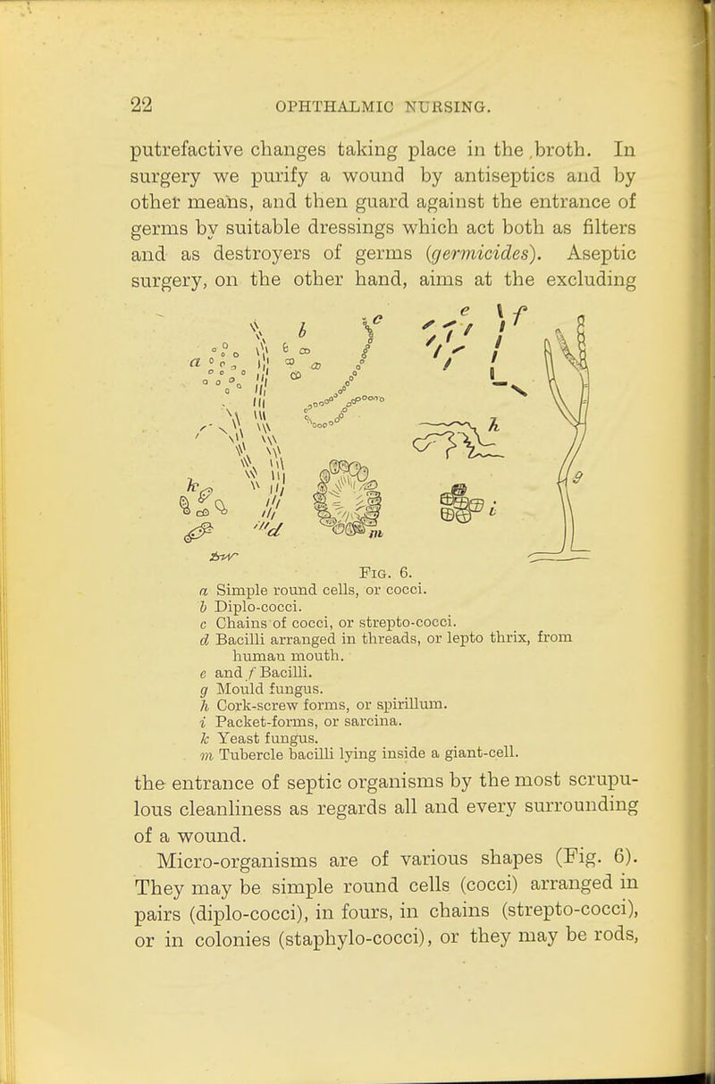 putrefactive changes taking place in the ,broth. In surgery we purify a wound by antiseptics and by other means, and then guard against the entrance of germs by suitable dressings which act both as filters and as destroyers of germs {germicides). Aseptic surgery, on the other hand, aims at the excluding Fig. 6. a Simple round cells, or cocci. b Diplo-cocci. c Chains'of cocci, or strepto-cocci. d Bacilli arranged in threads, or lepto thrix, from humau mouth. e and/'Bacilli. g Mould fungus. h Cork-screw forms, or spirillum. i Packet-forms, or sarcina. k Yeast fungus. m Tubercle bacilli lying inside a giant-cell. the entrance of septic organisms by the most scrupu- lous cleanliness as regards all and every surrounding of a wound. Micro-organisms are of various shapes (Fig. 6). They may be simple round cells (cocci) arranged in pairs (diplo-cocci), in fours, in chains (strepto-cocci), or in colonies (staphylo-cocci), or they may be rods,
