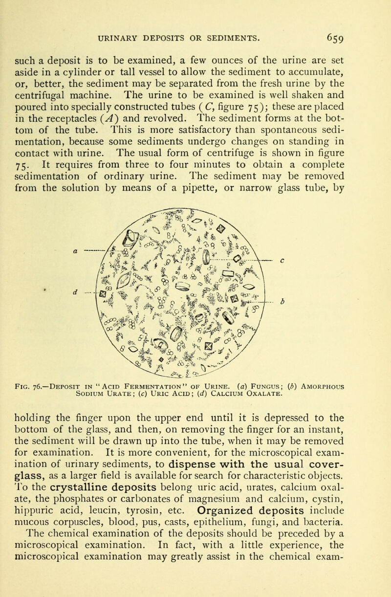 such a deposit is to be examined, a few ounces of the urine are set aside in a cylinder or tall vessel to allow the sediment to accumulate, or, better, the sediment may be separated from the fresh urine by the centrifugal machine. The urine to be examined is well shaken and poured into specially constructed tubes ( C, figure 75); these are placed in the receptacles (A) and revolved. The sediment forms at the bot- tom of the tube. This is more satisfactory than spontaneous sedi- mentation, because some sediments undergo changes on standing in contact with urine. The usual form of centrifuge is shown in figure 75. It requires from three to four minutes to obtain a complete sedimentation of ordinary urine. The sediment may be removed from the solution by means of a pipette, or narrow glass tube, by Fig. 76.—Deposit in Acid Fermentation of Urine, (a) Fungus; (3) Amorphous Sodium Urate; (c) Uric Acid; (d) Calcium Oxalate. holding the finger upon the upper end until it is depressed to the bottom of the glass, and then, on removing the finger for an instant, the sediment will be drawn up into the tube, when it may be removed for examination. It is more convenient, for the microscopical exam- ination of urinary sediments, to dispense with the usual cover- glass, as a larger field is available for search for characteristic objects. To the crystalline deposits belong uric acid, urates, calcium oxal- ate, the phosphates or carbonates of magnesium and calcium, cystin, hippuric acid, leucin, tyrosin, etc. Organized deposits include mucous corpuscles, blood, pus, casts, epithelium, fungi, and bacteria. The chemical examination of the deposits should be preceded by a microscopical examination. In fact, with a little experience, the microscopical examination may greatly assist in the chemical exam-