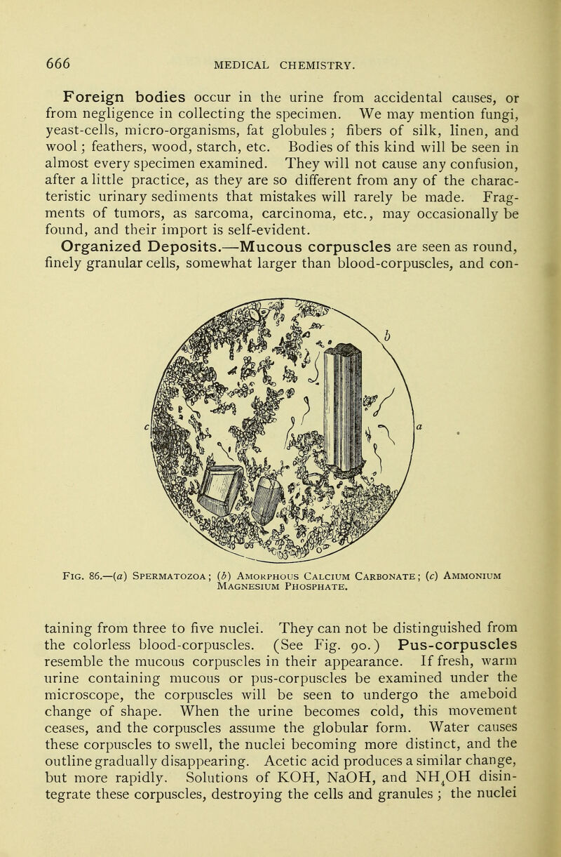 Foreign bodies occur in the urine from accidental causes, or from negligence in collecting the specimen. We may mention fungi, yeast-cells, micro-organisms, fat globules; fibers of silk, linen, and wool; feathers, wood, starch, etc. Bodies of this kind will be seen in almost every specimen examined. They will not cause any confusion, after a little practice, as they are so different from any of the charac- teristic urinary sediments that mistakes will rarely be made. Frag- ments of tumors, as sarcoma, carcinoma, etc., may occasionally be found, and their import is self-evident. Organized Deposits.—Mucous corpuscles are seen as round, finely granular cells, somewhat larger than blood-corpuscles, and con- Fig. 86.—(a) Spermatozoa; {b) Amorphous Calcium Carbonate; (c) Ammonium Magnesium Phosphate. taining from three to five nuclei. They can not be distinguished from the colorless blood-corpuscles. (See Fig. 90.) Pus-corpuscles resemble the mucous corpuscles in their appearance. If fresh, warm urine containing mucous or pus-corpuscles be examined under the microscope, the corpuscles will be seen to undergo the ameboid change of shape. When the urine becomes cold, this movement ceases, and the corpuscles assume the globular form. Water causes these corpuscles to swell, the nuclei becoming more distinct, and the outline gradually disappearing. Acetic acid produces a similar change, but more rapidly. Solutions of KOH, NaOH, and NH4OH disin- tegrate these corpuscles, destroying the cells and granules ; the nuclei