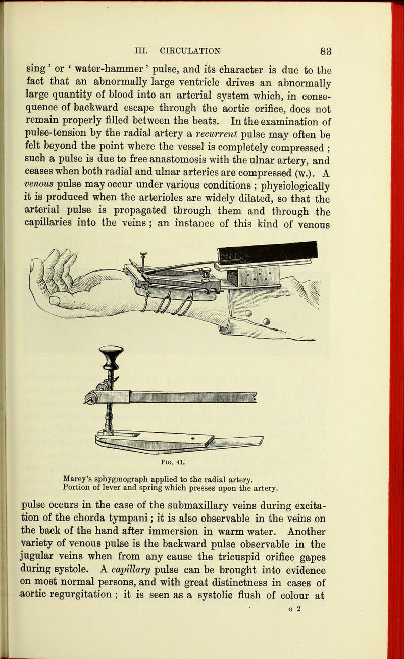 sing' or * water-hammer' pulse, and its character is due to the fact that an abnormally large ventricle drives an abnormally large quantity of blood into an arterial system which, in conse- quence of backward escape through the aortic orifice, does not remain properly filled between the beats. In the examination of pulse-tension by the radial artery a recurrent pulse may often be felt beyond the point where the vessel is completely compressed ; such a pulse is due to free anastomosis with the ulnar artery, and ceases when both radial and ulnar arteries are compressed (w.). A venous pulse may occur under various conditions ; physiologically it is produced when the arterioles are widely dilated, so that the arterial pulse is propagated through them and through the capillaries into the veins ; an instance of this kind of venous Pig, 41. Marey's sphygmograph applied to the radial artery. Portion of lever and spring which presses upon the artery, pulse occurs in the case of the submaxillary veins during excita- tion of the chorda tympani; it is also observable in the veins on the back of the hand after immersion in warm water. Another variety of venous pulse is the backward pulse observable in the jugular veins when from any cause the tricuspid orifice gapes during systole. A capillary pulse can be brought into evidence on most normal persons, and with great distinctness in cases of aortic regurgitation ; it is seen as a systolic flush of colour at