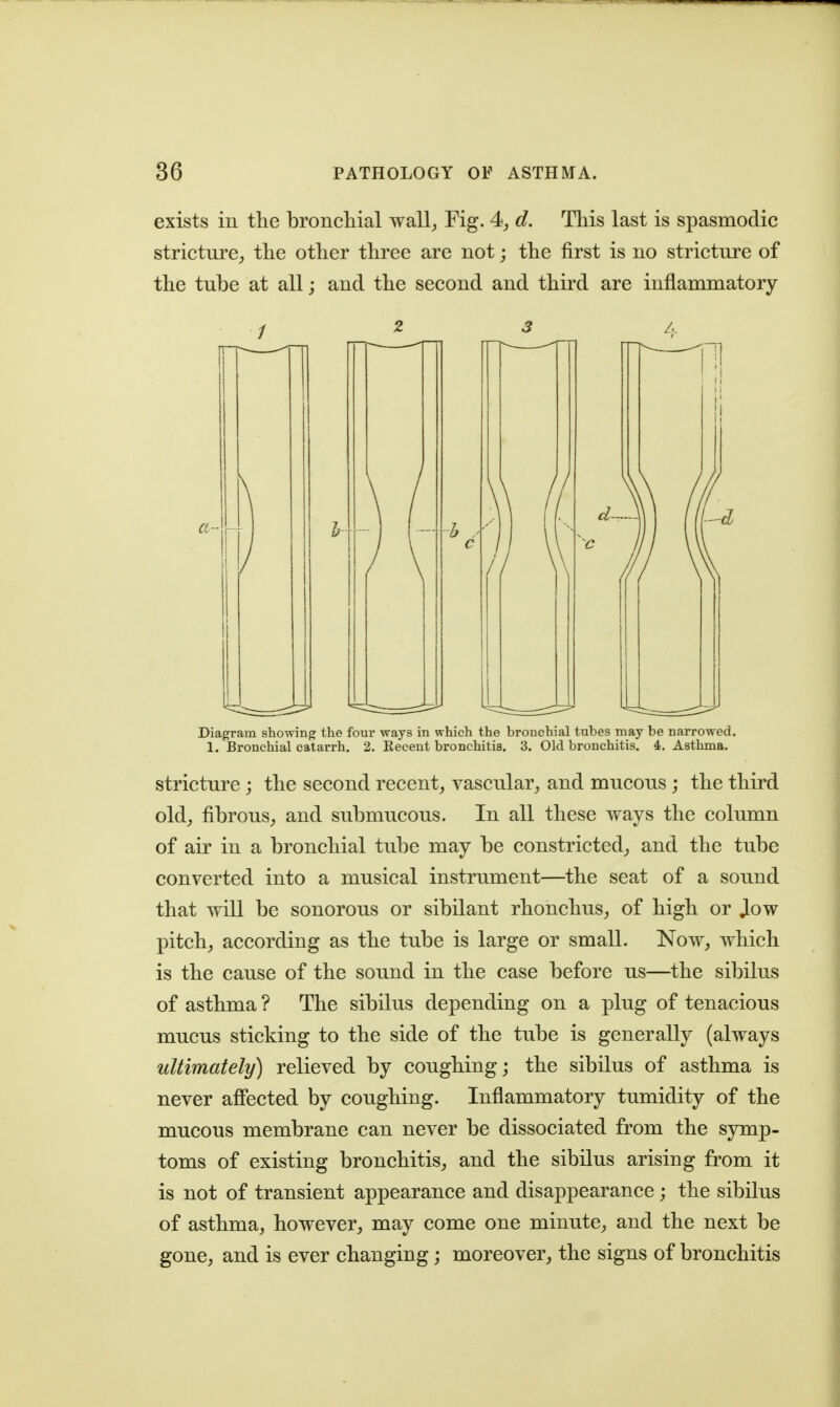 exists in the broncliial wall,, Fig. 4^ d. This last is spasmodic stricture^ the other three are not; the first is no stricture of the tube at all; and the second and third are inflammatory Z 3 A Diagram showing the four ways in which the bronchial tubes may be narrowed. 1. Bronchial catarrh. 2. Kecent bronchitis. 3. Old bronchitis. 4. Asthma. stricture; the second recent, vascular, and mucous ; the third old, fibrous, and submucous. In all these ways the column of air in a bronchial tube may be constricted, and the tube converted into a musical instrument—the seat of a sound that will be sonorous or sibilant rhonchus, of high or Jow pitch, according as the tube is large or small. Now, which is the cause of the sound in the case before us—the sibilus of asthma? The sibilus depending on a plug of tenacious mucus sticking to the side of the tube is generally (always ultimately) relieved by coughing; the sibilus of asthma is never affected by coughing. Inflammatory tumidity of the mucous membrane can never be dissociated from the symp- toms of existing bronchitis, and the sibilus arising from it is not of transient appearance and disappearance; the sibilus of asthma, however, may come one minute, and the next be gone, and is ever changing; moreover, the signs of bronchitis