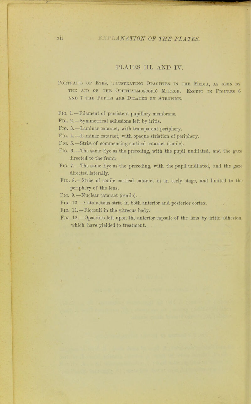 PLATES III. AND IV. I'ORTPwMTS OF EyEB, ILLUSTRATING OPACITIES INT THE MeDIA, AS SEEK BY THE AID OF THE OPHTHALMOSCOPIC MiHROR. ExCEPT IN FIGURES 6 AND 7 THE Pupils are Dilated by Atropine. Fig. 1.—Filament of persistent pupillary membrane. Fig. 2.—Sjnnmetrical adhesions left by iritis. Fig. 3.—Laminar cataract, with transparent peripheiy. Fig. 4.—Laminar cataract, with opaque striation of periphery. Fig. 5.—Strise of commencing cortical cataract (senile). Fig. 6.—The same Eye as the preceding, with the pupil undilated, and the gaze directed to the front. Fig. 7. —The same Eye as the preceding, with the pupil undilated, and the gaze directed laterally. Fig. 3.—Strias of senile cortical cataract in an early stage, and limited to the periphery of the lens. Fig. 9.—Nuclear cataract (senile). Fig. 10.—Cataractous sti-ise in both anterior and posterior cortex. Fig, 11.—Flocculi in the vitreous body. Fig. 12.—Opacities left upon the anterior capsule of the lens by iritic adhesion which have yielded to treatment.