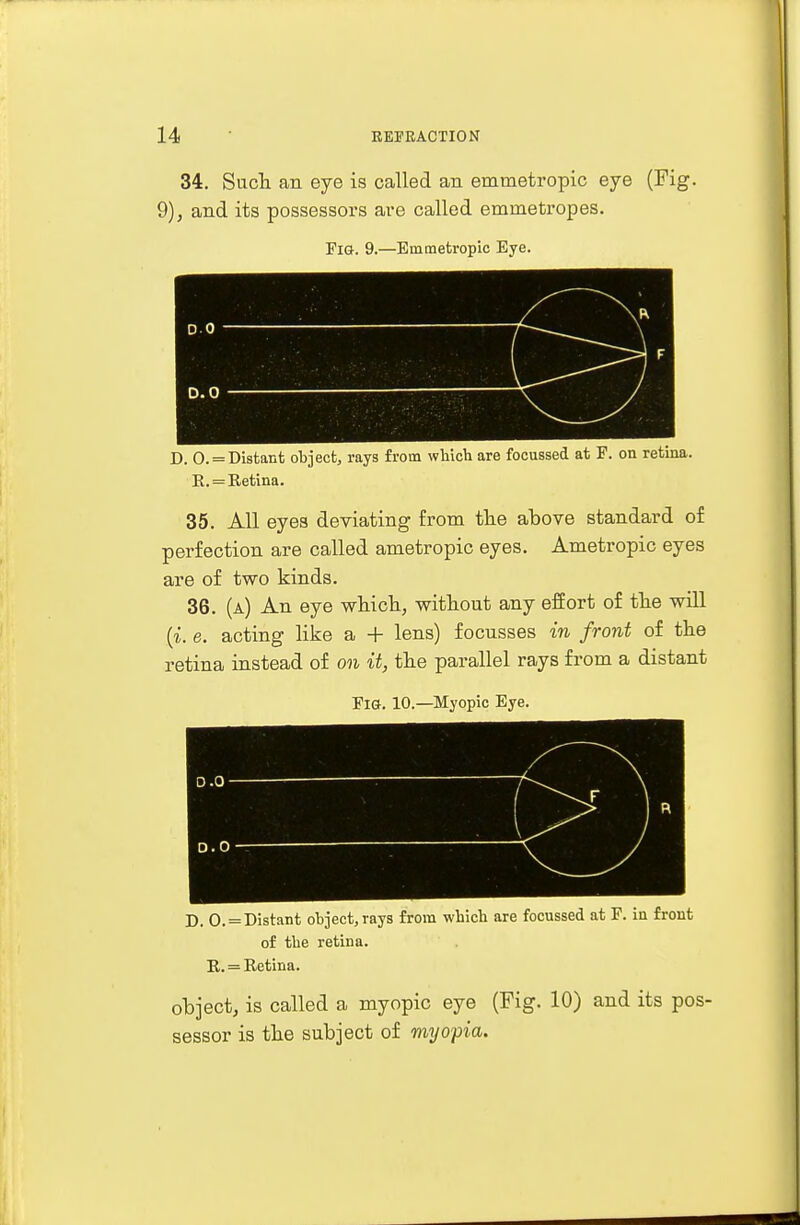 34. Such an eye is called an emmetropic eye (Fig. 9), and its possessors are called emrnetropes. Fig. 9.—Emmetropic Eye. ( d. u D. 0. = Distant object, rays from which are focussed at F. on retina. R. = Retina. 35. All eyes deviating from the above standard of perfection are called ametropic eyes. Ametropic eyes are of two kinds. 36. (a) An eye which, without any effort of the will (i. e. acting like a + lens) focusses in front of the retina instead of on it, the parallel rays from a distant Fig. 10.—Myopic Eye. D. 0. = Distant object, rays from which are focussed at F. in front of the retina. R.= Retina. object, is called a myopic eye (Fig. 10) and its pos- sessor is the subject of myopia.