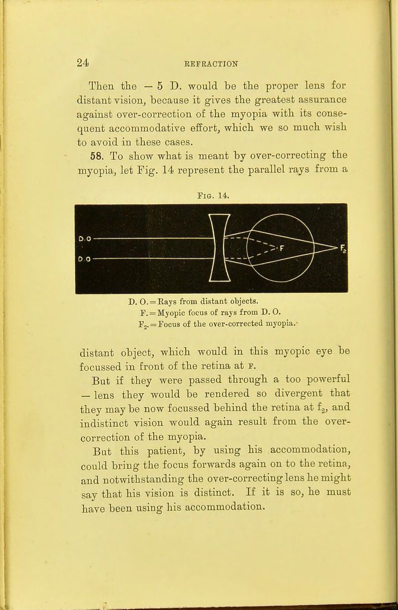 Then the — 5 D. would be the proper lens for distant vision, because it gives the greatest assurance against over-correction of the myopia with its conse- quent accommodative effort, which we so much wish to avoid in these cases. 58. To show what is meant by over-correcting the myopia, let Fig. 14 represent the parallel rays from a Fig. 14. D. 0. = Rays from distant objects. F. = Myopic focus of rays from D. 0. P2. = Focus of the over-corrected myopia.- distant object, which would in this myopic eye be focussed in front of the retina at p. But if they were passed through a too powerful — lens they would be rendered so divergent that they may be now focussed behind the retina at f3, and indistinct vision would again result from the over- correction of the myopia. But this patient, by using his accommodation, could bring the focus forwards again on to the retina, and notwithstanding the over-correcting lens he might say that his vision is distinct. If it is so, he must have been using his accommodation.