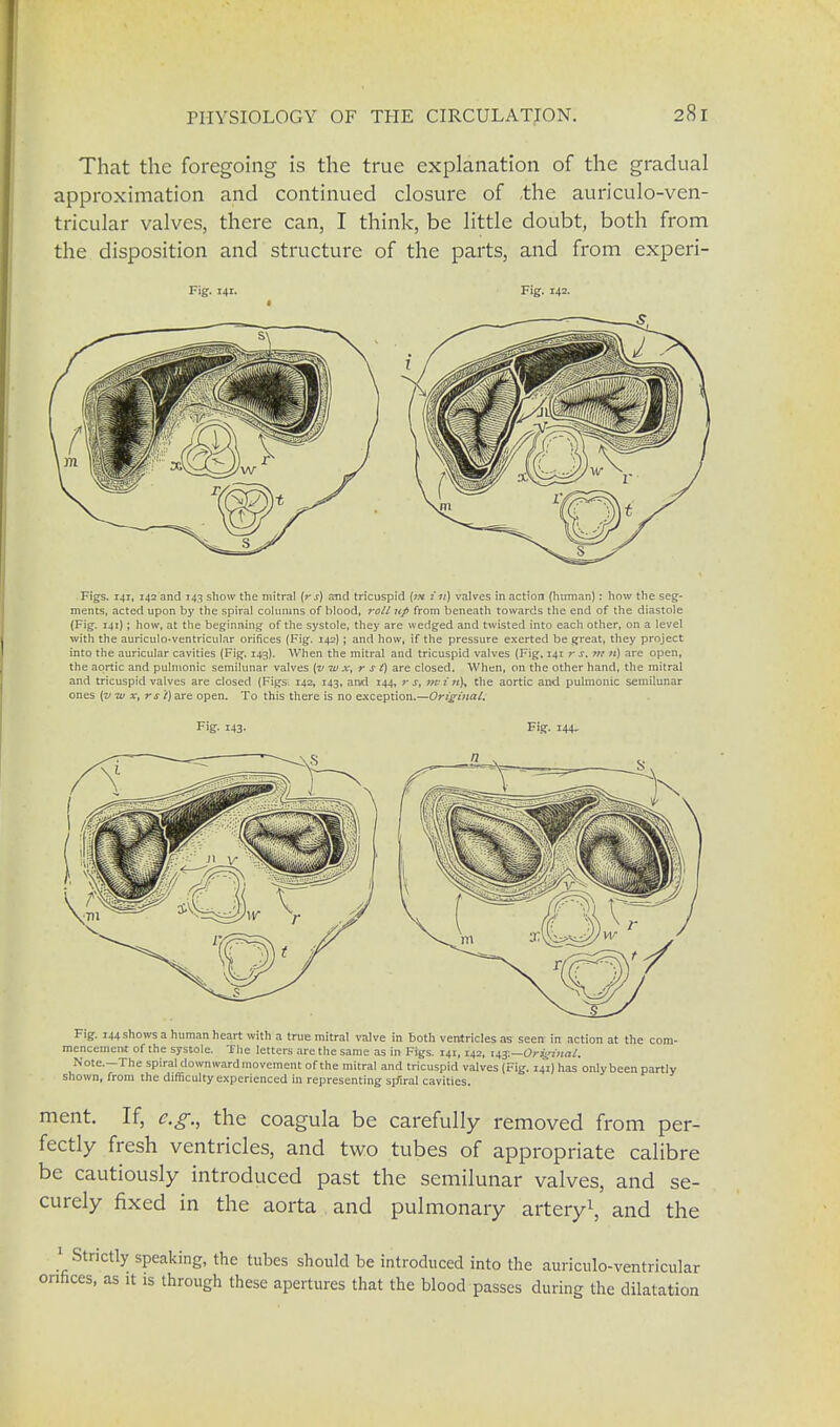 That the foregoing is the true explanation of the gradual approximation and continued closure of the auriculo-ven- tricular valves, there can, I think, be little doubt, both from the disposition and structure of the parts, and from experi- Fig. 141. Fig. 142. Figs. 141, 142 and 143 show the mitral (rj) and tricuspid (m in) valves in action (human): how the seg- ments, acted upon by the spiral columns of blood, roll up from beneath towards the end of the diastole (Fig. 141); how, at the beginning of the systole, they are wedged and twisted into each other, on a level with the auriculo-ventricular orifices (Fig. 142) ; and how, if the pressure exerted be great, they project into the auricular cavities (Fig. 143). When the mitral and tricuspid valves (Fig. 141 r s.m n) are open, the aortic and pulmonic semilunar valves (v w x, r s t) are closed. When, on the other hand, the mitral and tricuspid valves are closed (Figs. 142, 143, and 144, r s, w> i «K the aortic and pulmonic semilunar ones (vw x, rs i) are open. To this there is no exception.—Origina I. F'g- 143- Fig. 144. Fig. 144 shows a human heart with a true mitral valve in both ventricles as seen in action at the com- mencement of the systole. The letters are the same as in Figs. 141,142, us.—Original. Note.—The spiral downward movement of the mitral and tricuspid valves (Fig. 141) has only been partly shown, from the difficulty experienced in representing sffiral cavities. ment. If, e.g., the coagula be carefully removed from per- fectly fresh ventricles, and two tubes of appropriate calibre be cautiously introduced past the semilunar valves, and se- curely fixed in the aorta and pulmonary artery1, and the 1 Strictly speaking, the tubes should be introduced into the auriculo-ventricular onfices, as it is through these apertures that the blood passes during the dilatation