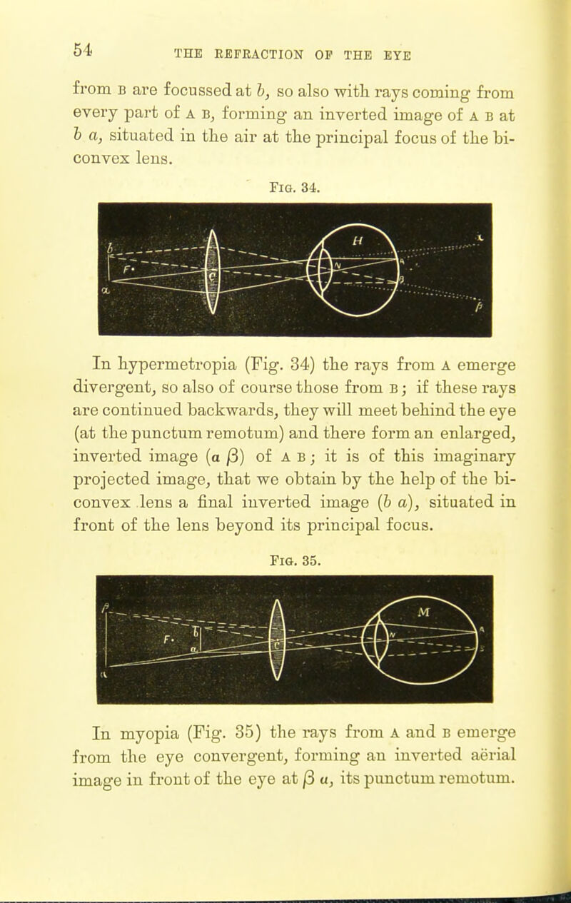 from B are focussed at b, so also with rays coming from every part of a b, forming an inverted image of A b at h a, situated in the air at the principal focus of the bi- convex lens. Fig. 34. a ■—i -i > In hypermetropia (Fig. 34) the rays from a emerge divergent^ so also of course those from b ; if these rays are continued backwards, they will meet behind the eye (at the punctum remotum) and there form an enlarged, inverted image (a j3) of A b ; it is of this imaginary projected image, that we obtain by the help of the bi- convex lens a final inverted image [b a), situated in front of the lens beyond its principal focus. Fig. 35. In myopia (Fig- 35) the rays from A and b emerge from the eye convergent, forming an inverted aerial image in fi*ont of the eye at j3 a, its punctum remotum.