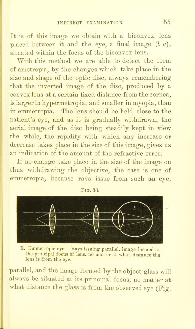 It is of tliis image we obtain witli a biconvex lens placed between it and tlie eye^ a final image (6 a), situated witbin the focus of the biconvex lens. Witli tliis method we are able to detect the form of ametropia, by the chang'es which take place in the size and shape of the optic disc, always remembering that the inverted image of the disc, produced by a convex lens at a certain fixed distance from the cornea, is larger in hypermetropia, and smaller in myopia, than in emmetropia. The lens should be held close to the patient's eye, and as it is gradually withdrawn, the aerial image of the disc being steadily kept in view the while, the rapidity with which any increase or decrease takes place in the size of this image, gives us an indication of the amount of the refractive error. If no change take place in the size of the image on thus withdrawing the objective, the case is one of emmetropia, because rays issue from such an eye. Fig. 36. E. Emmetropic eye. Rays issuing parallel, image formed at the principal focus of lens, no matter at what distance the lens is from the eye. parallel, and the image formed by the object-glass will always be situated at its principal focus, no matter at what distance the glass is from the observed eye (Fig.